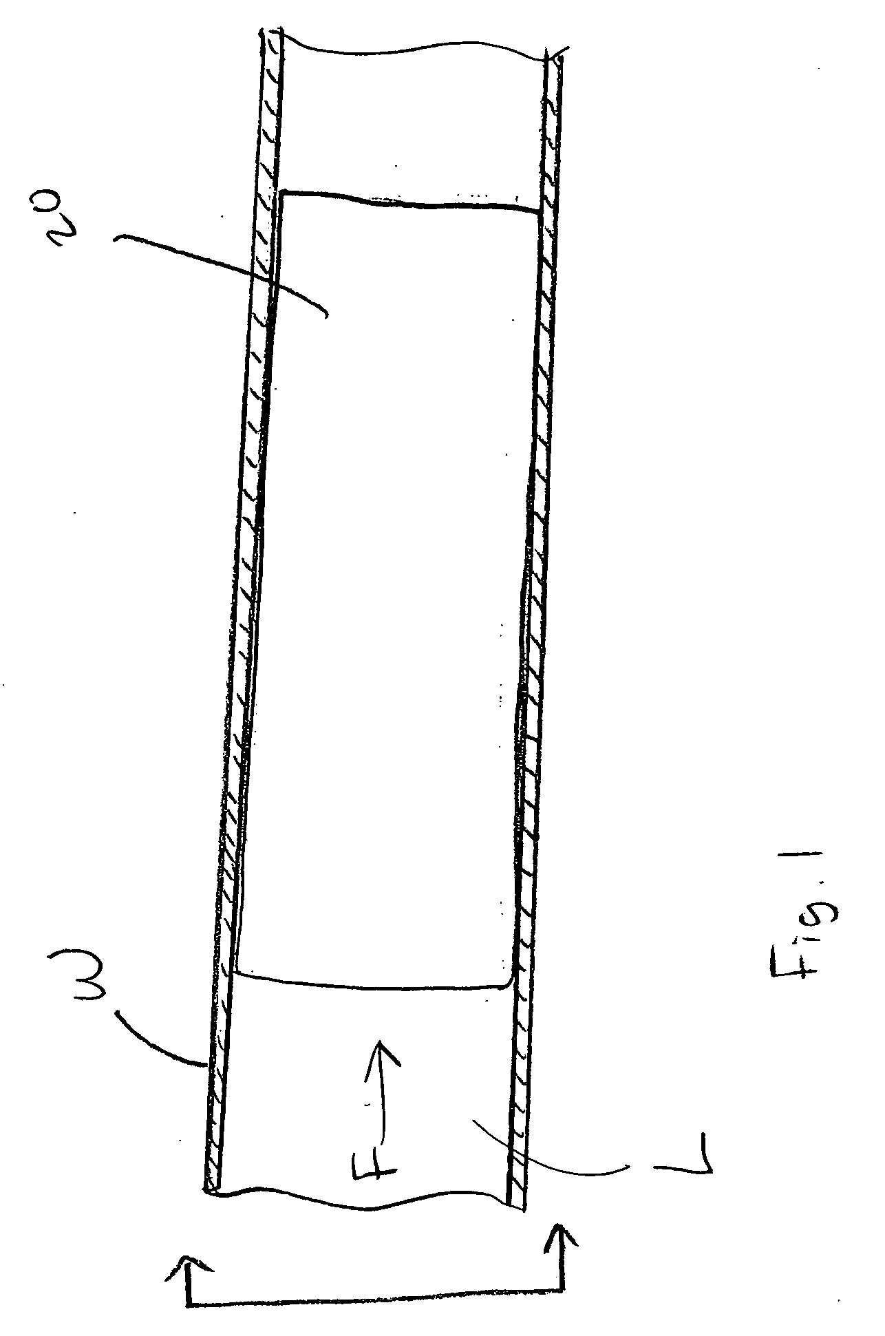 Bioabsorbable stent