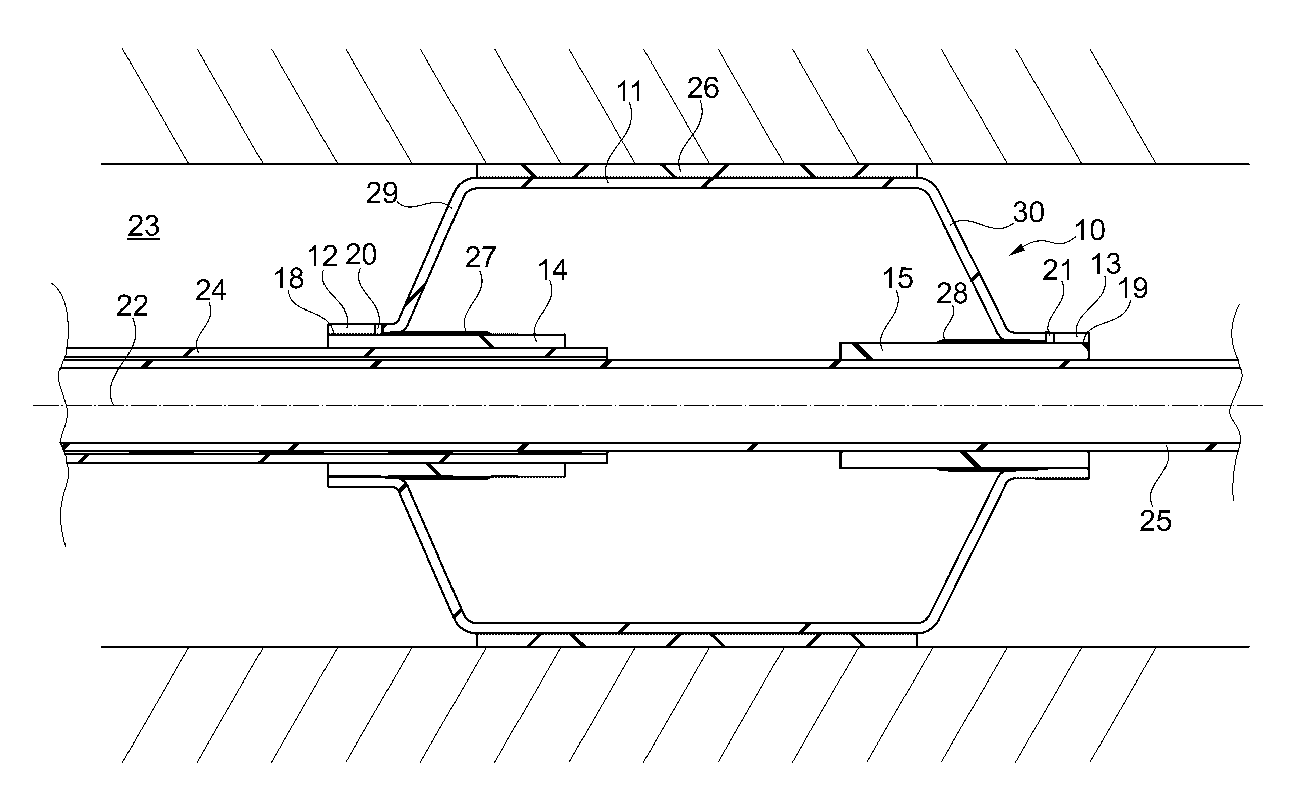 Medical balloon for a catheter