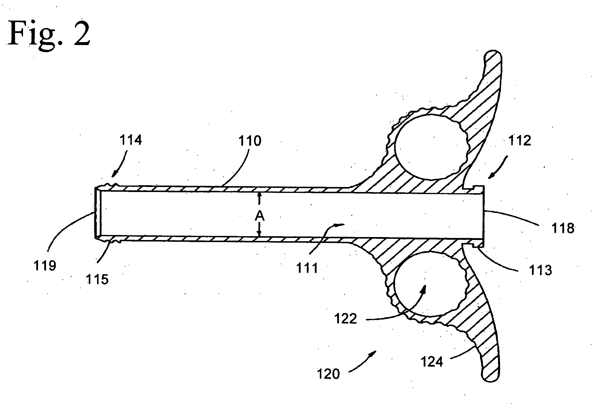 Graft syringe assembly