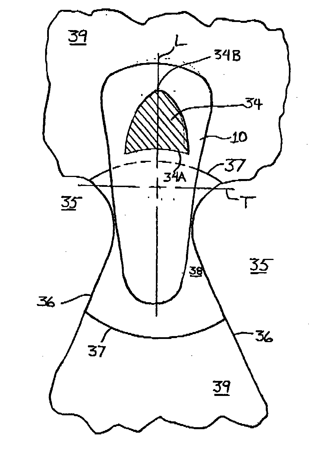 Absorbent article having a functional enhancement indicator