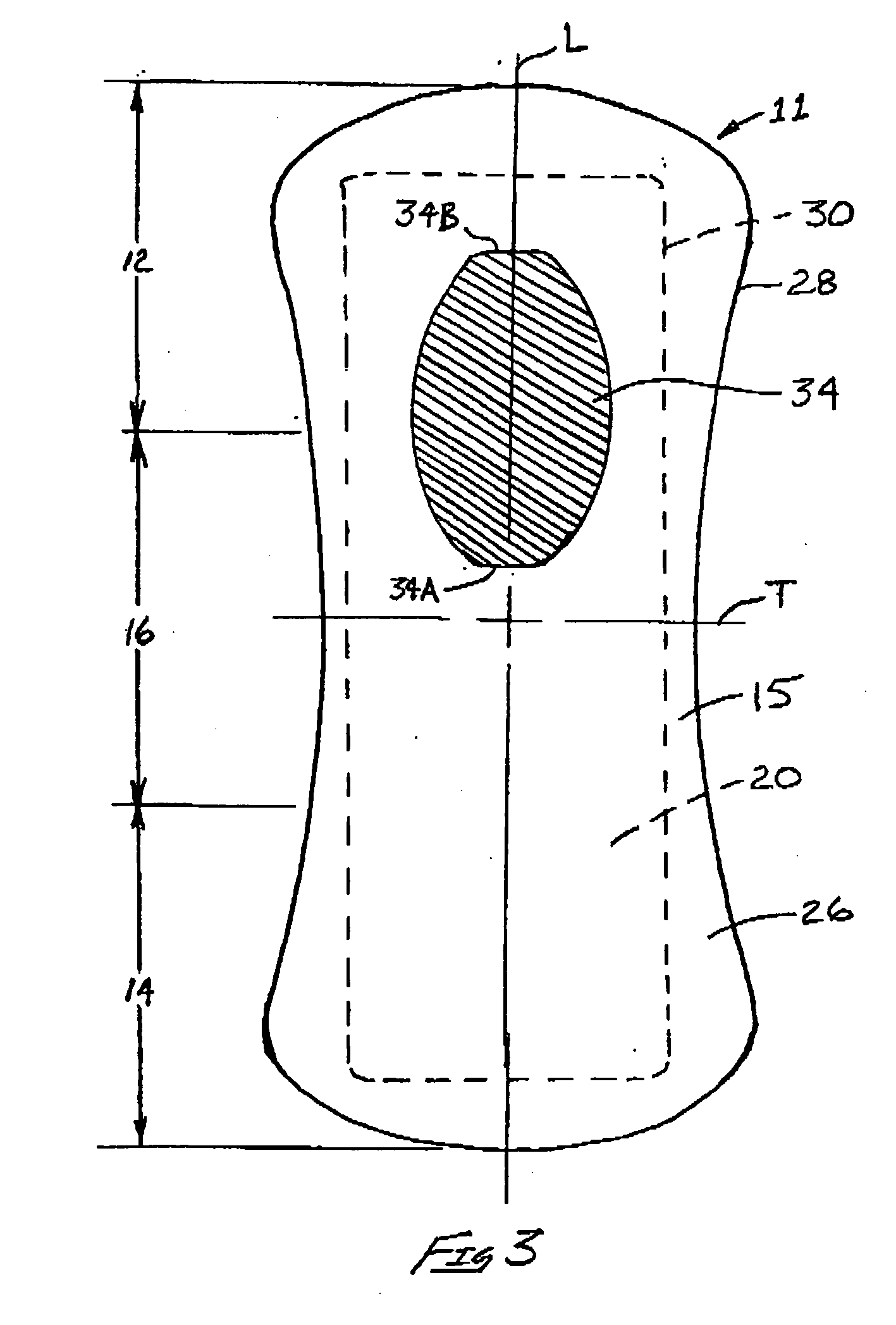 Absorbent article having a functional enhancement indicator