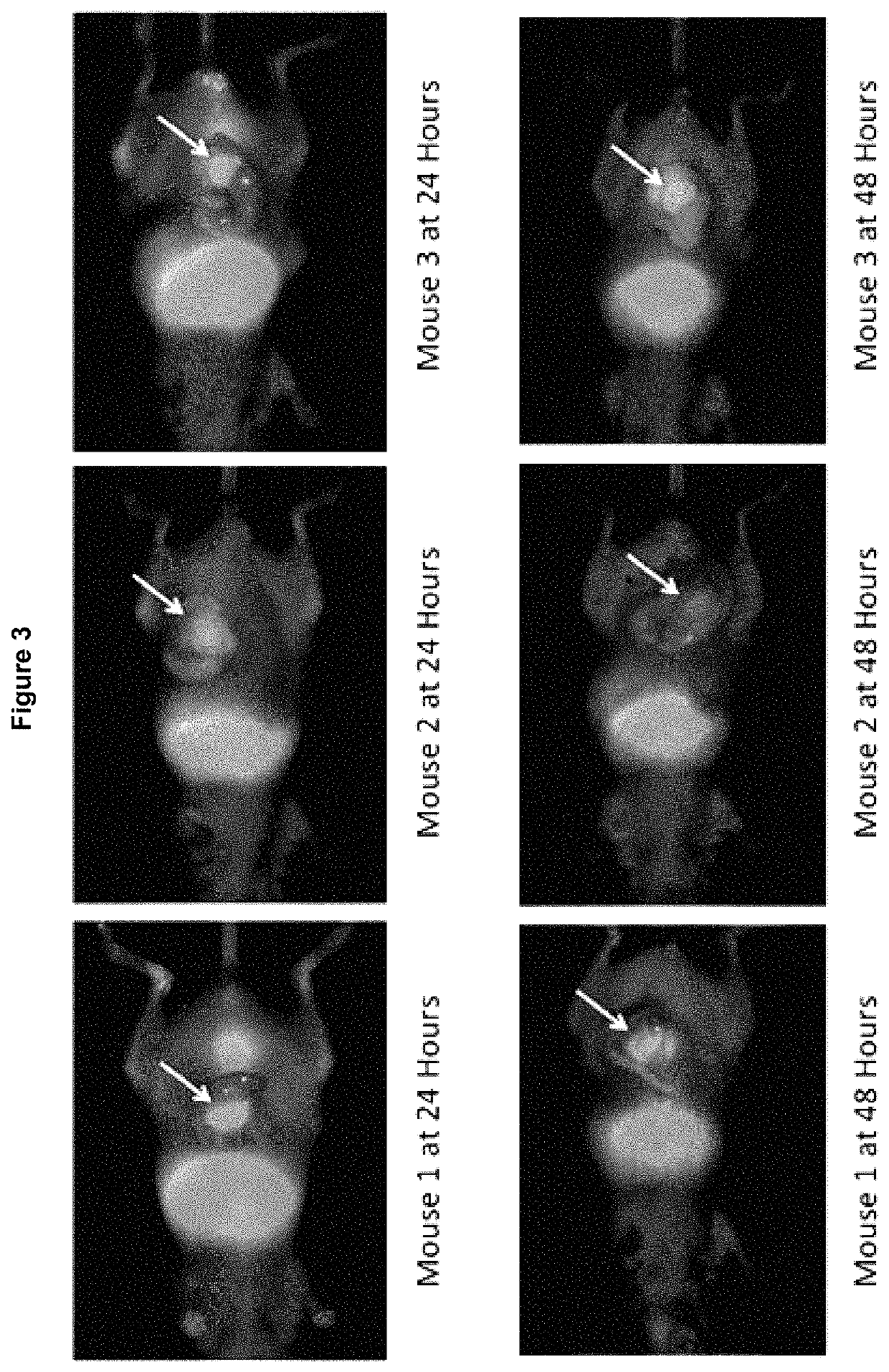 NIR-conjugated tumor-specific antibodies and uses thereof