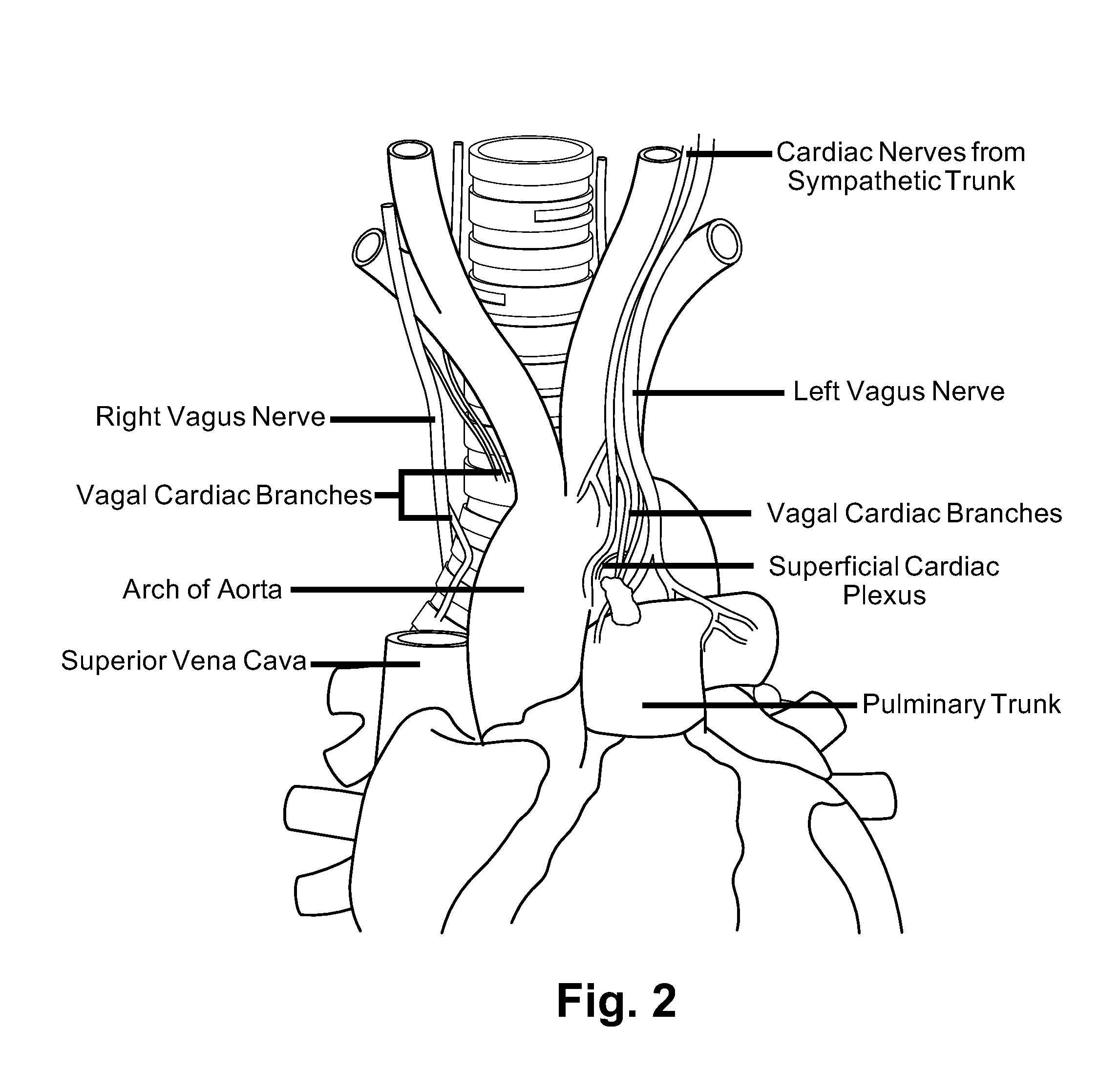 Device, system, and method for modulating cardiac function