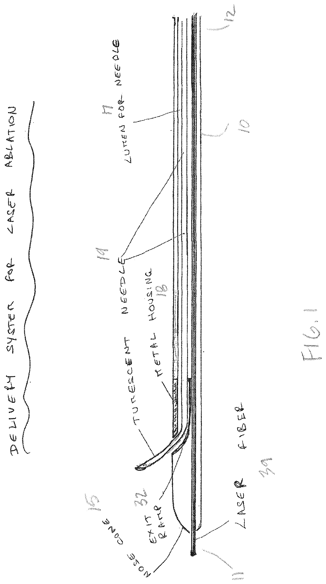 Venous ablation catheter and method