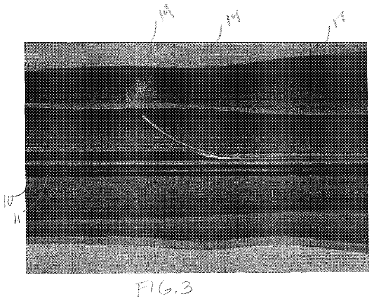 Venous ablation catheter and method