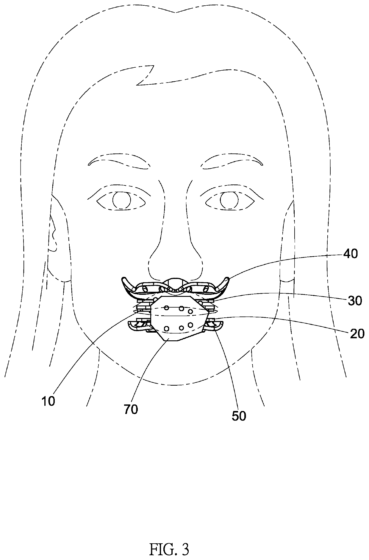 Fully edentulous jaw 3D facial universal temporal relationship recording device