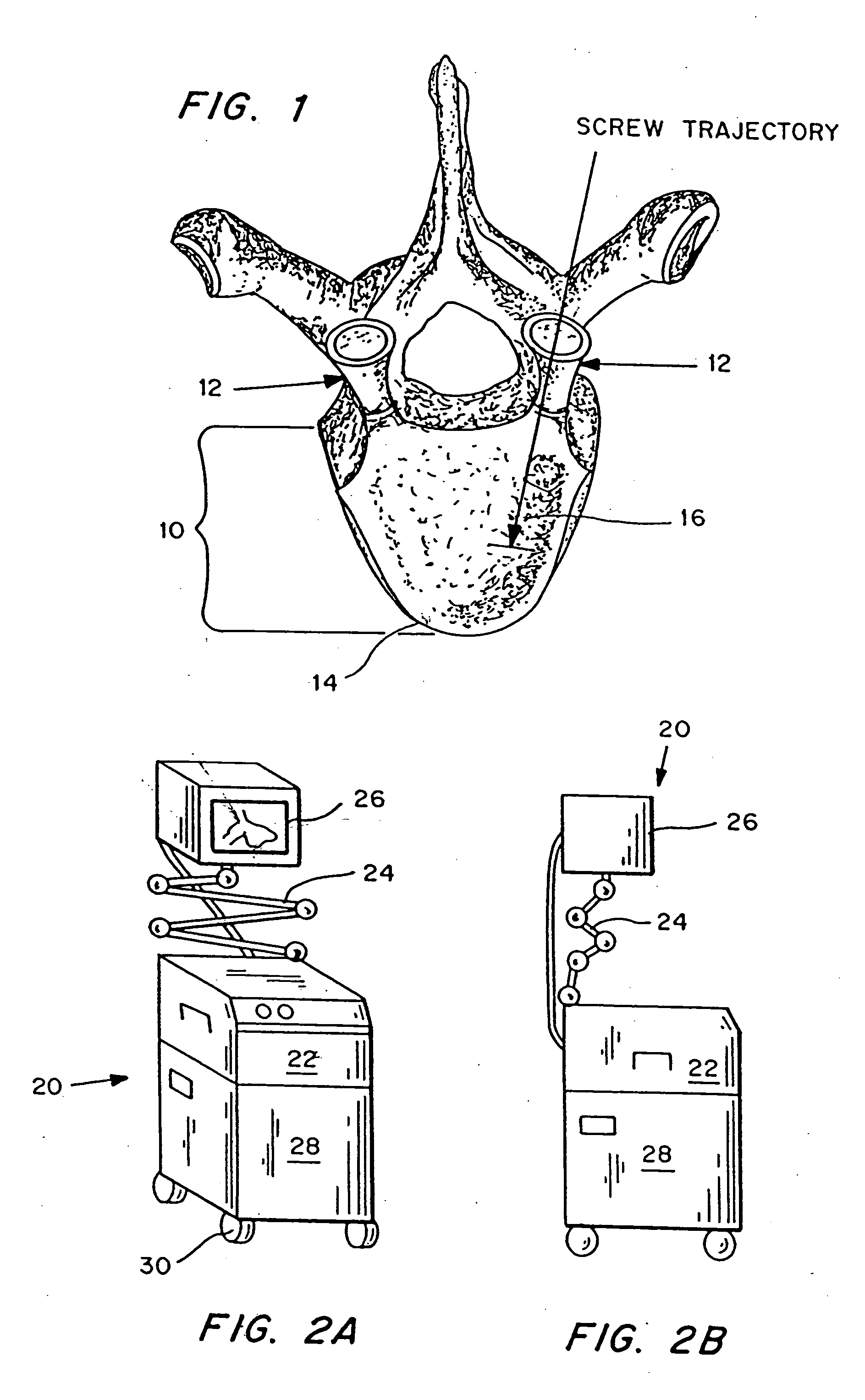 Intraosteal ultrasound during surgical implantation