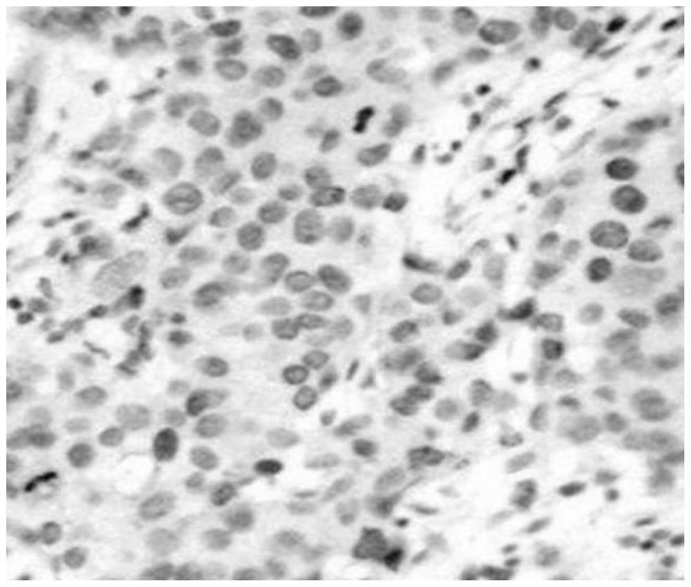 Primer, probe, kit and detection method for detecting ESR1 gene expression