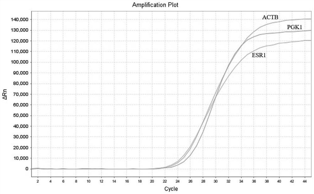 Primer, probe, kit and detection method for detecting ESR1 gene expression