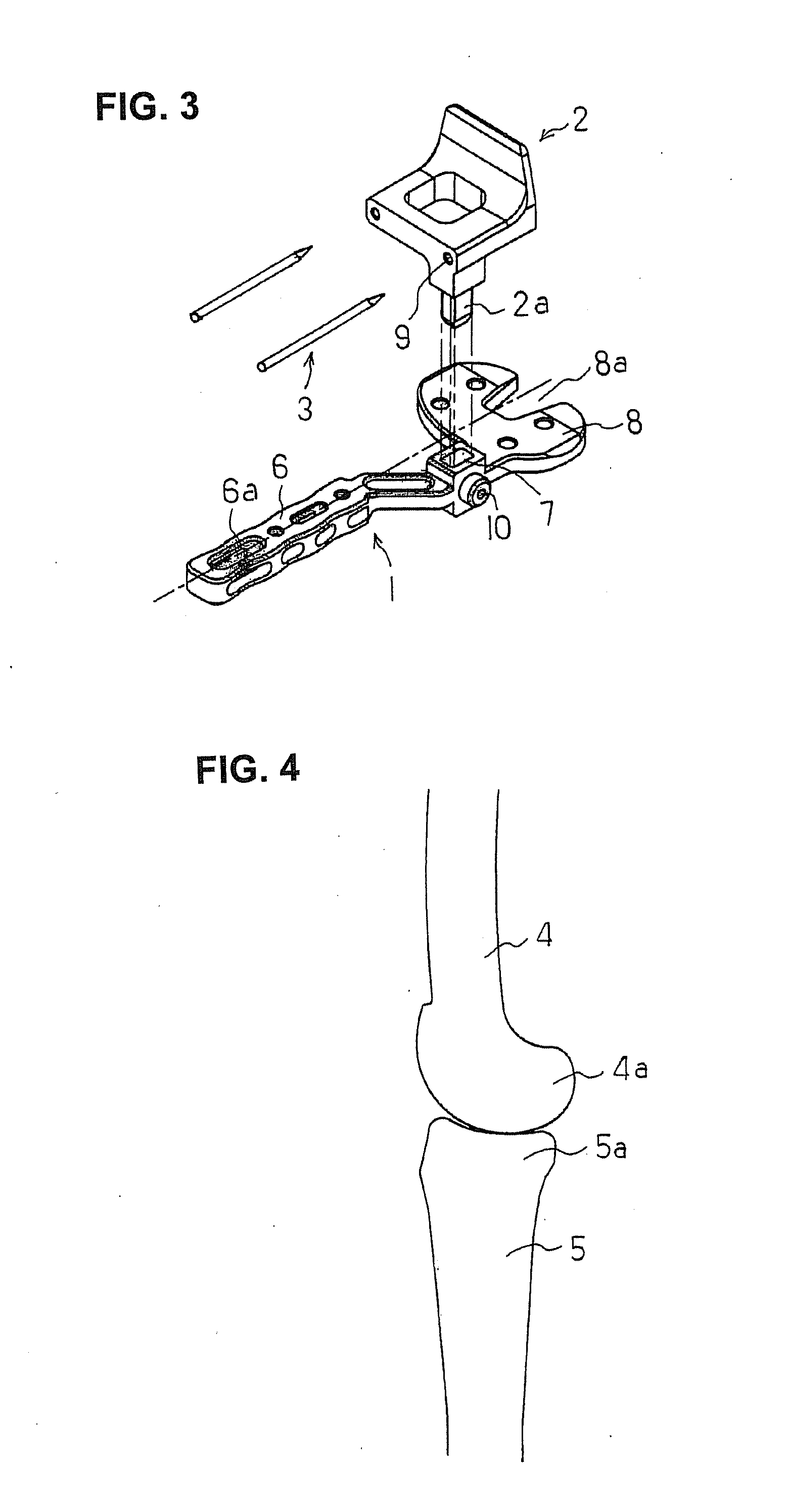 Bone Resection Jig Used in Artificial Knee Joint Replacement Surgery