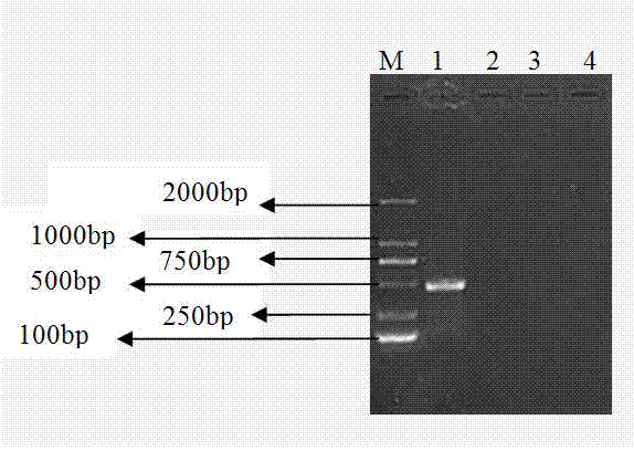 Multiple PCR detection kit for three bacterial seed-borne diseases and special primer for kit as well as multiple PCR detection method