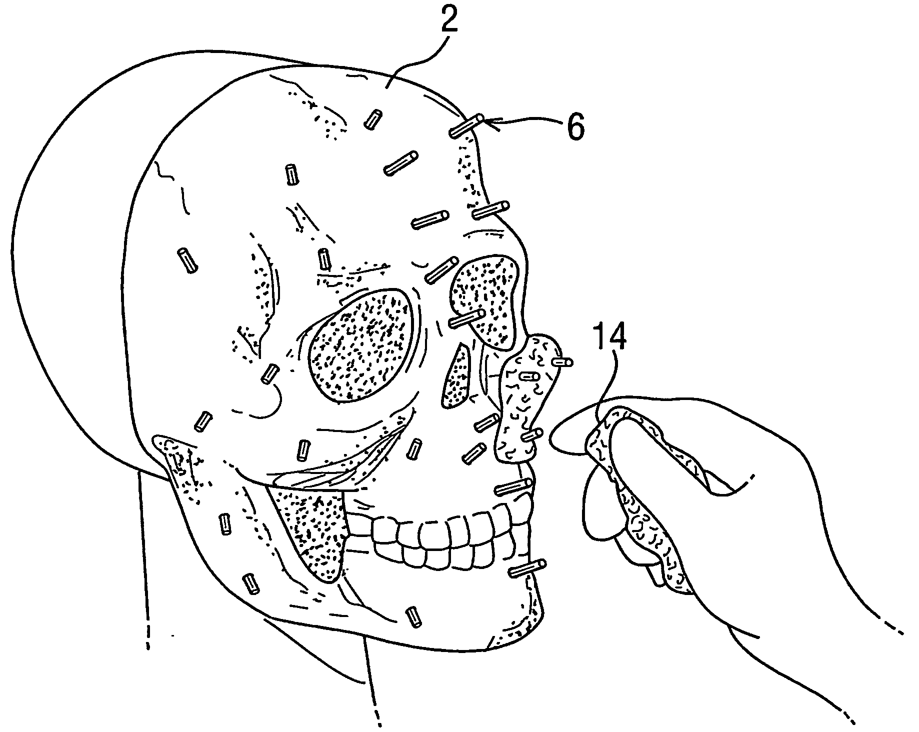 Sculpture apparatus and method