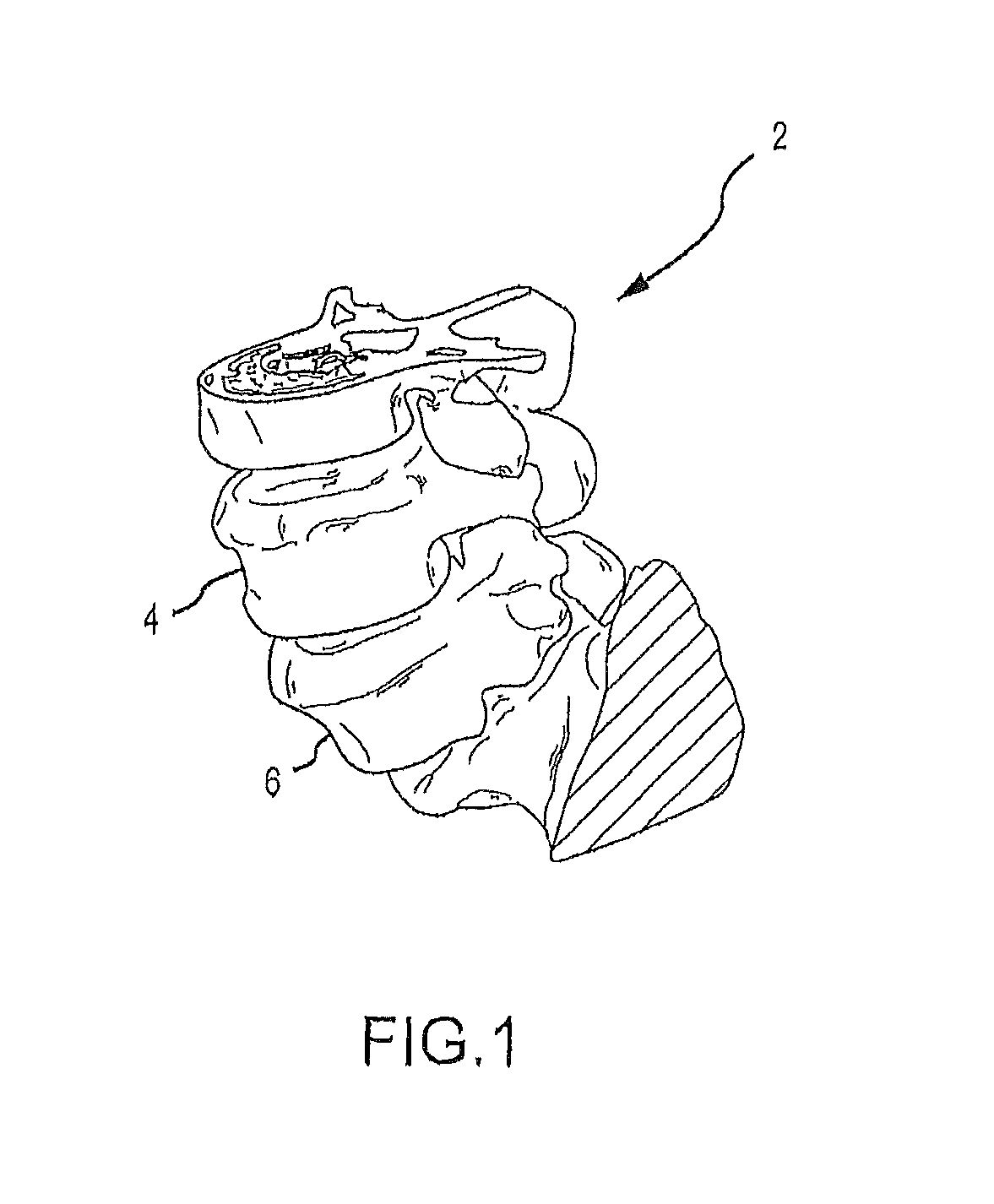 Patient-matched apparatus and methods for performing surgical procedures