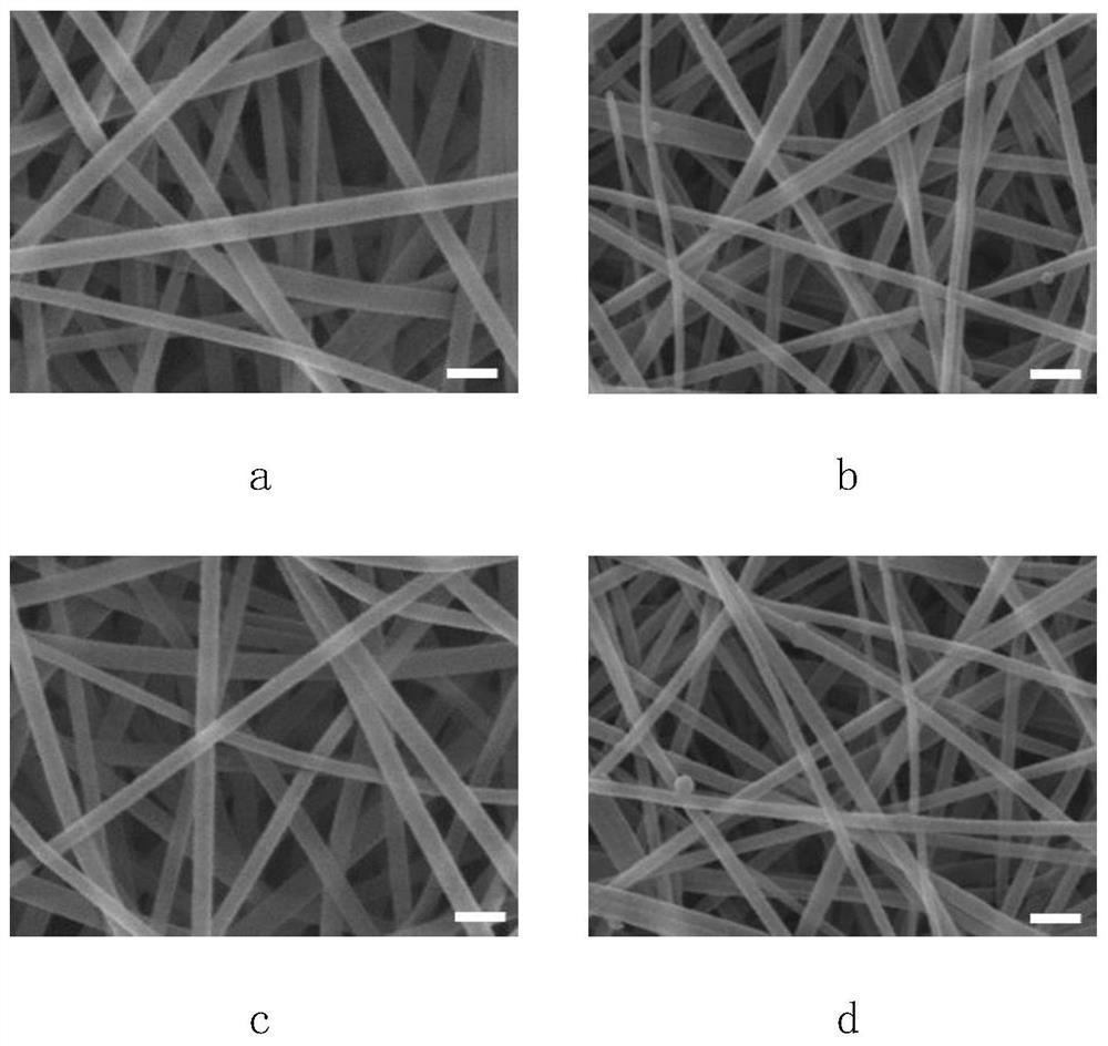 A preparation method of multifunctional electrospun fiber dressing