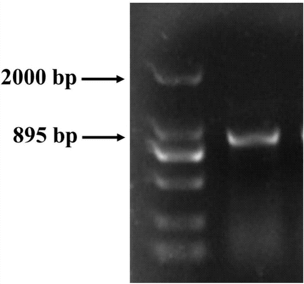 Detection kit and detecting method for new potyviridae virus in nelumbo nucifera