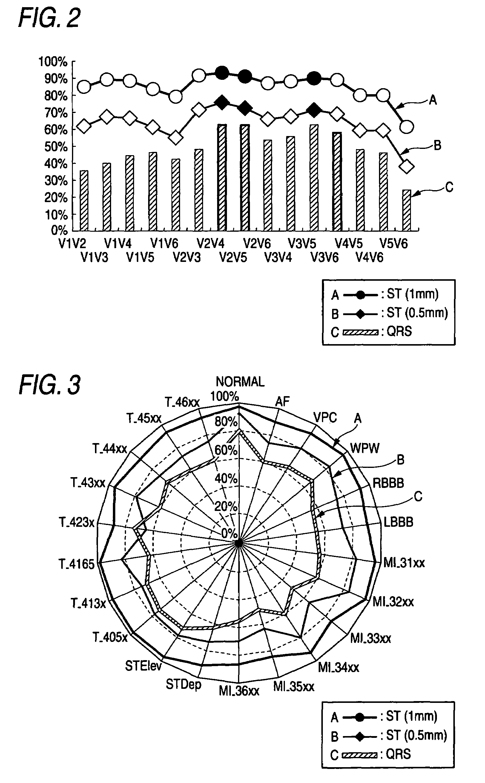 Method for deriving standard 12-lead electrocardiogram, and electrocardiograph using the same