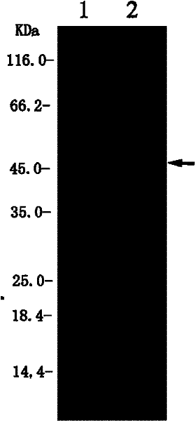 Preparation method of tumor detection nanoprobe