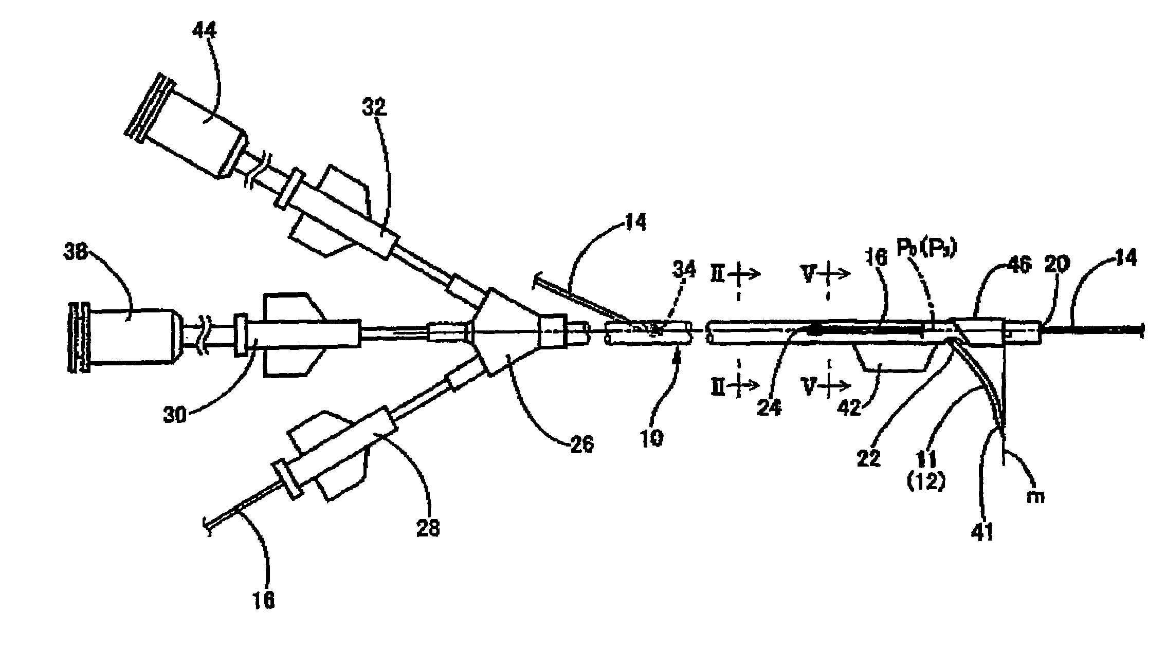 Infusion device