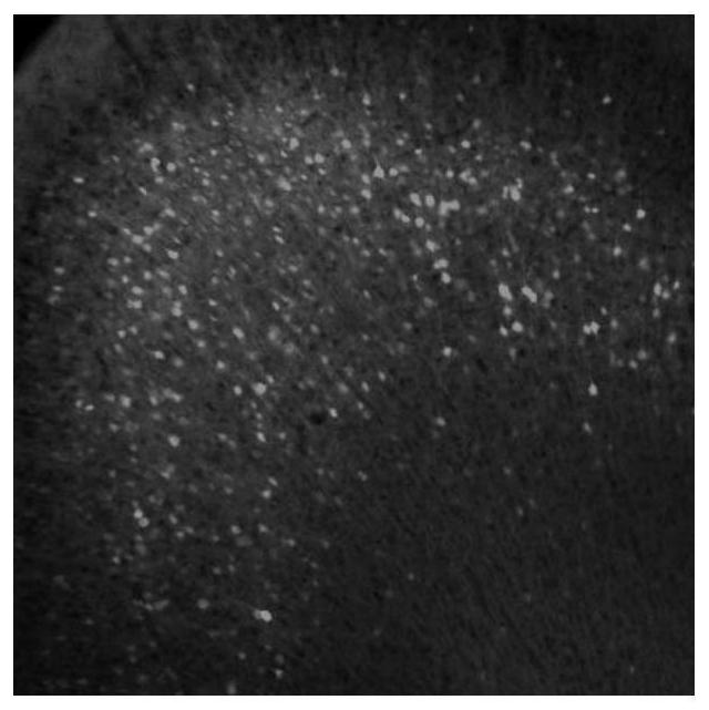 Recombinant adeno-associated virus packaging plasmid, recombinant adeno-associated virus and application of recombinant adeno-associated virus packaging plasmid