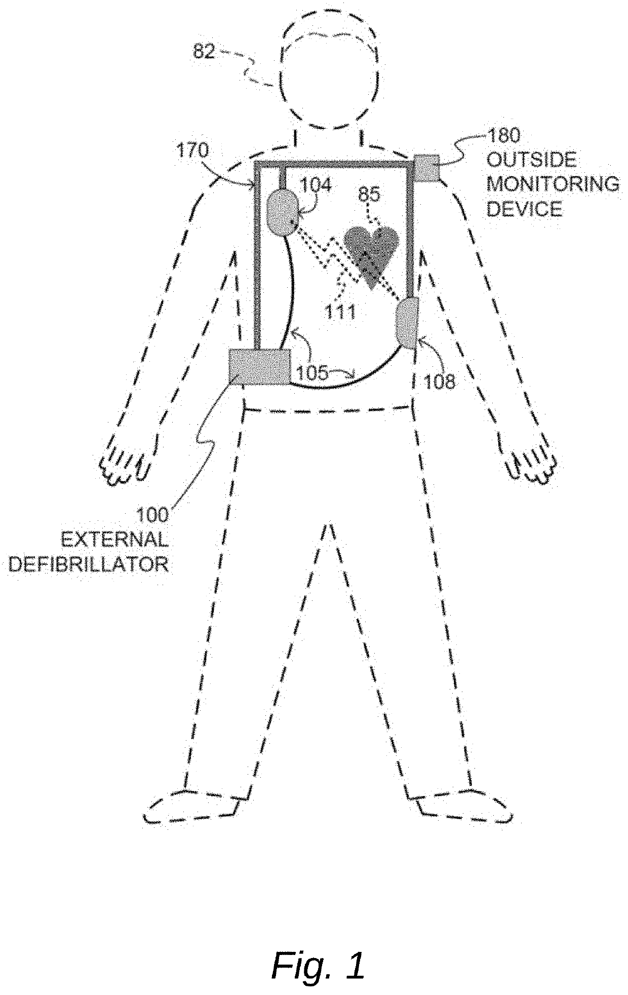 Data channel selection and timeline navigation in a cardiac monitoring system