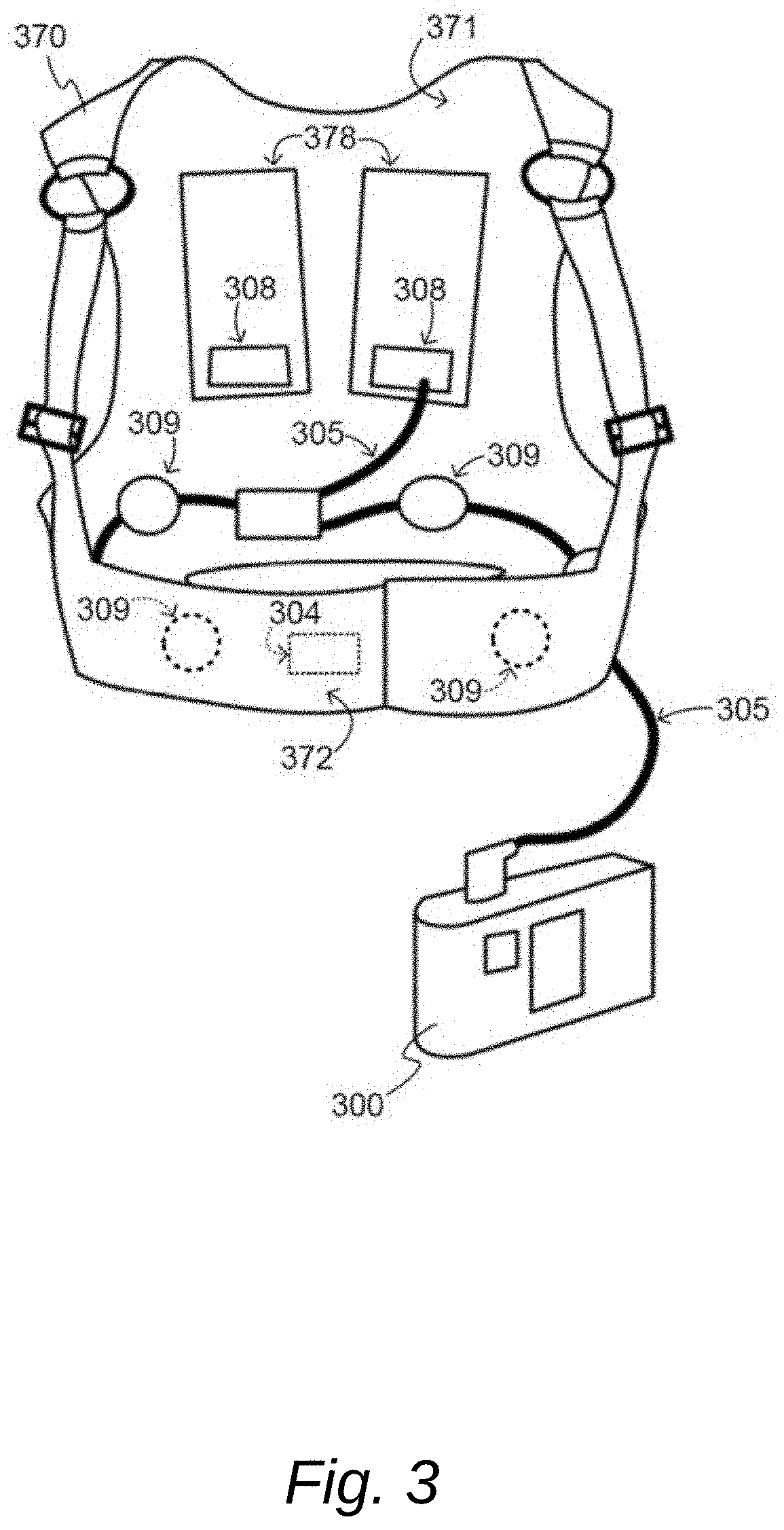 Data channel selection and timeline navigation in a cardiac monitoring system