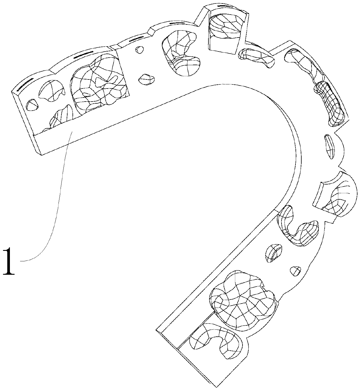 Method for direct bonding of orthodontic brackets