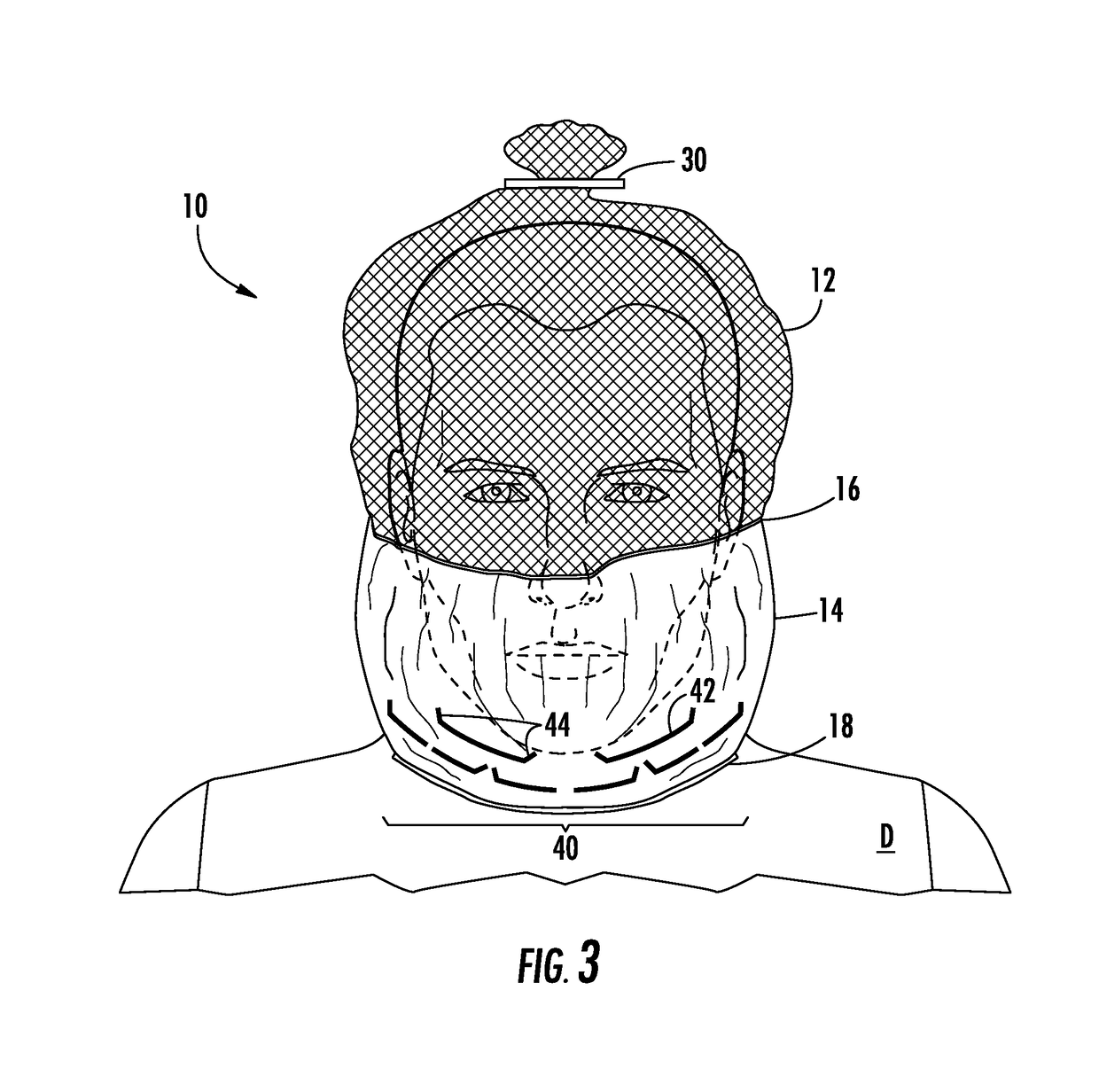 Transport hood having perforations