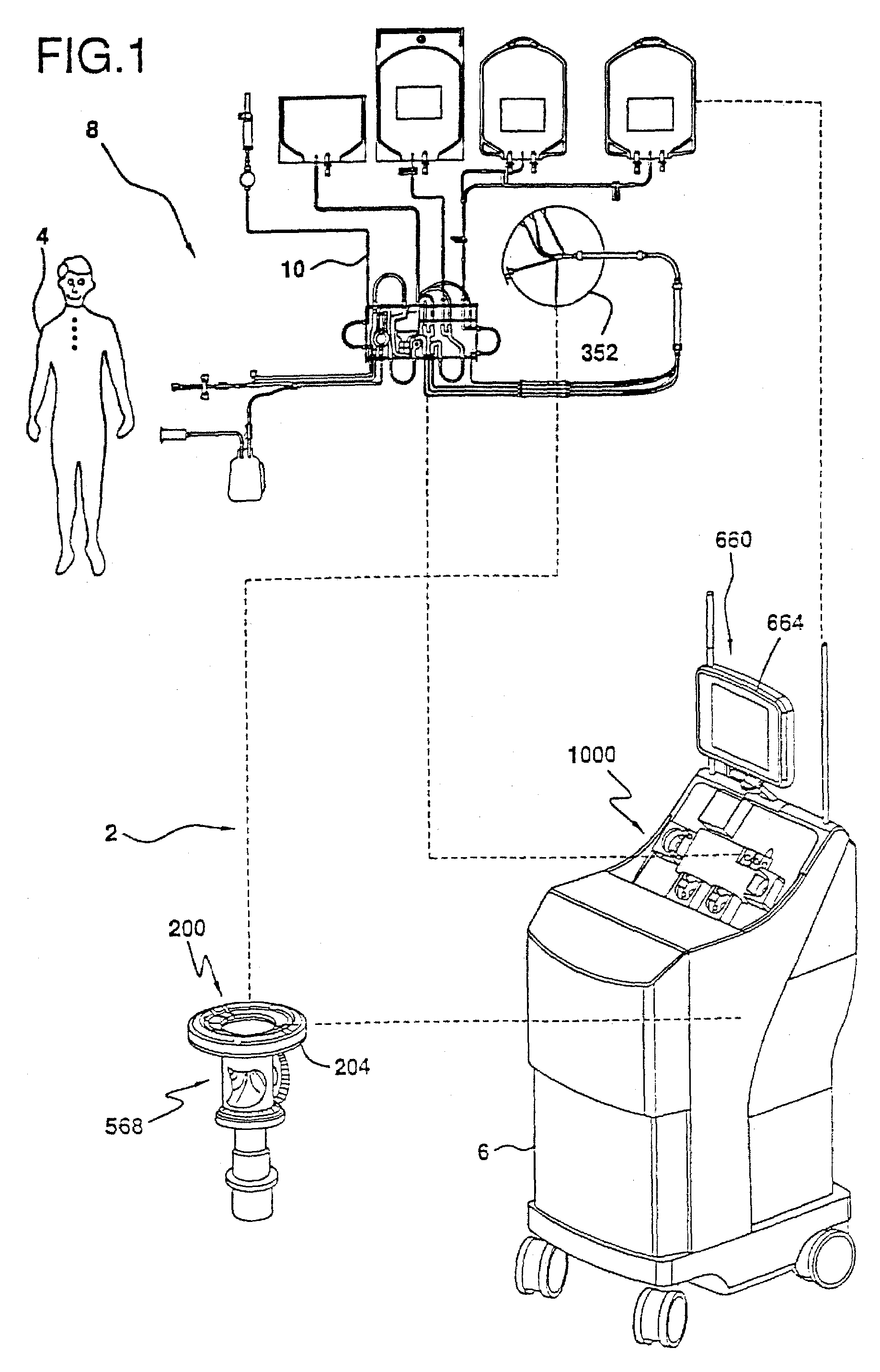 Extracorporeal blood processing methods and apparatus