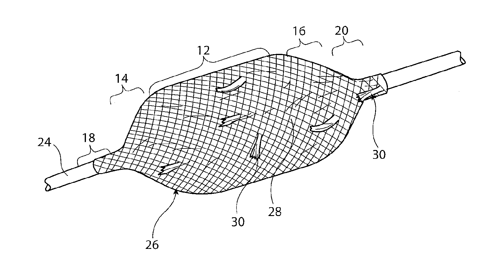 Vascular occlusion device