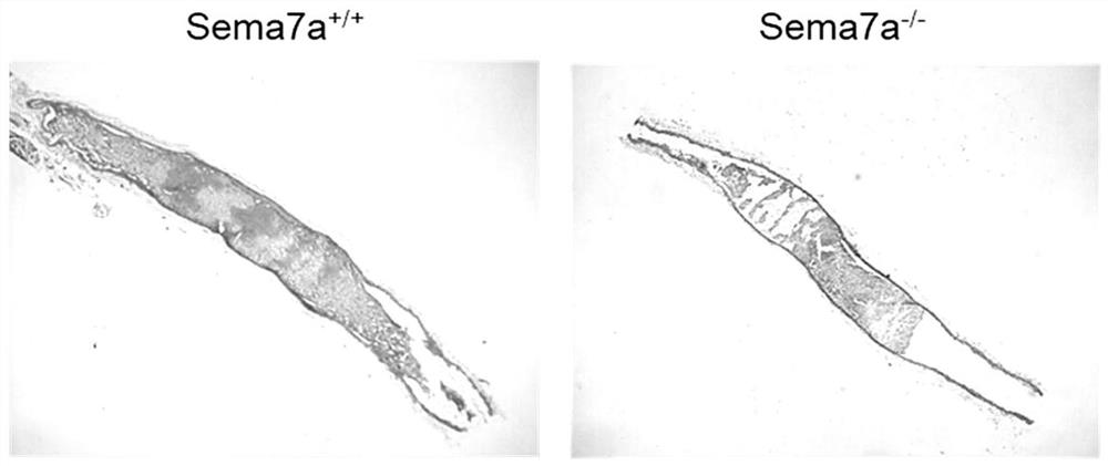 Application of Semaphorin7A monoclonal antibody in preparation of medicine for treating thrombus and cerebrovascular diseases