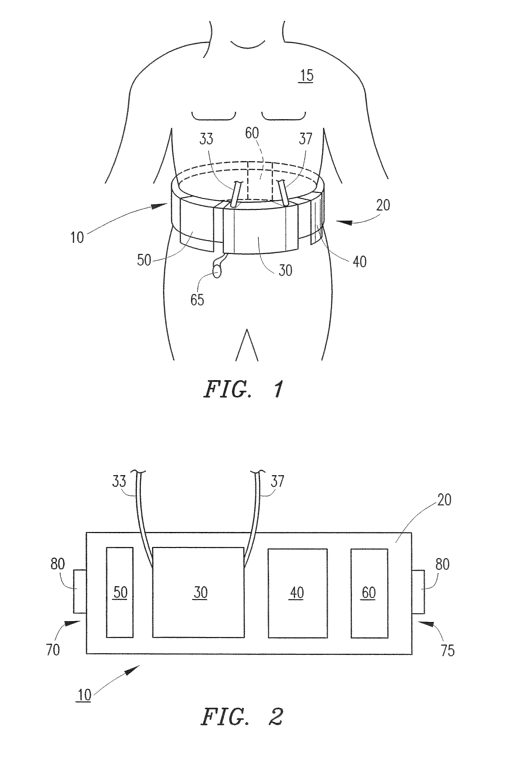 Wearable continuous renal replacement therapy device