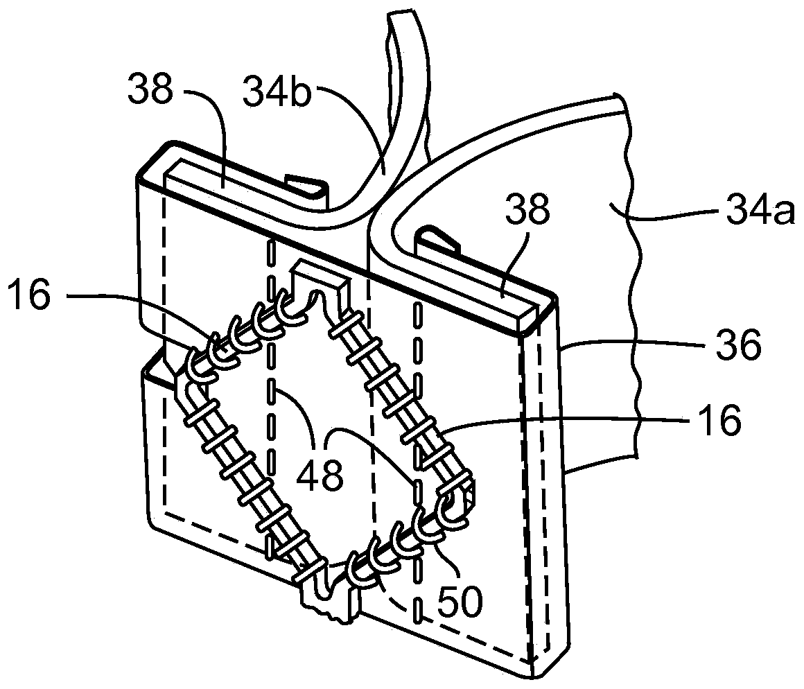 Prosthetic heart valve and delivery apparatus