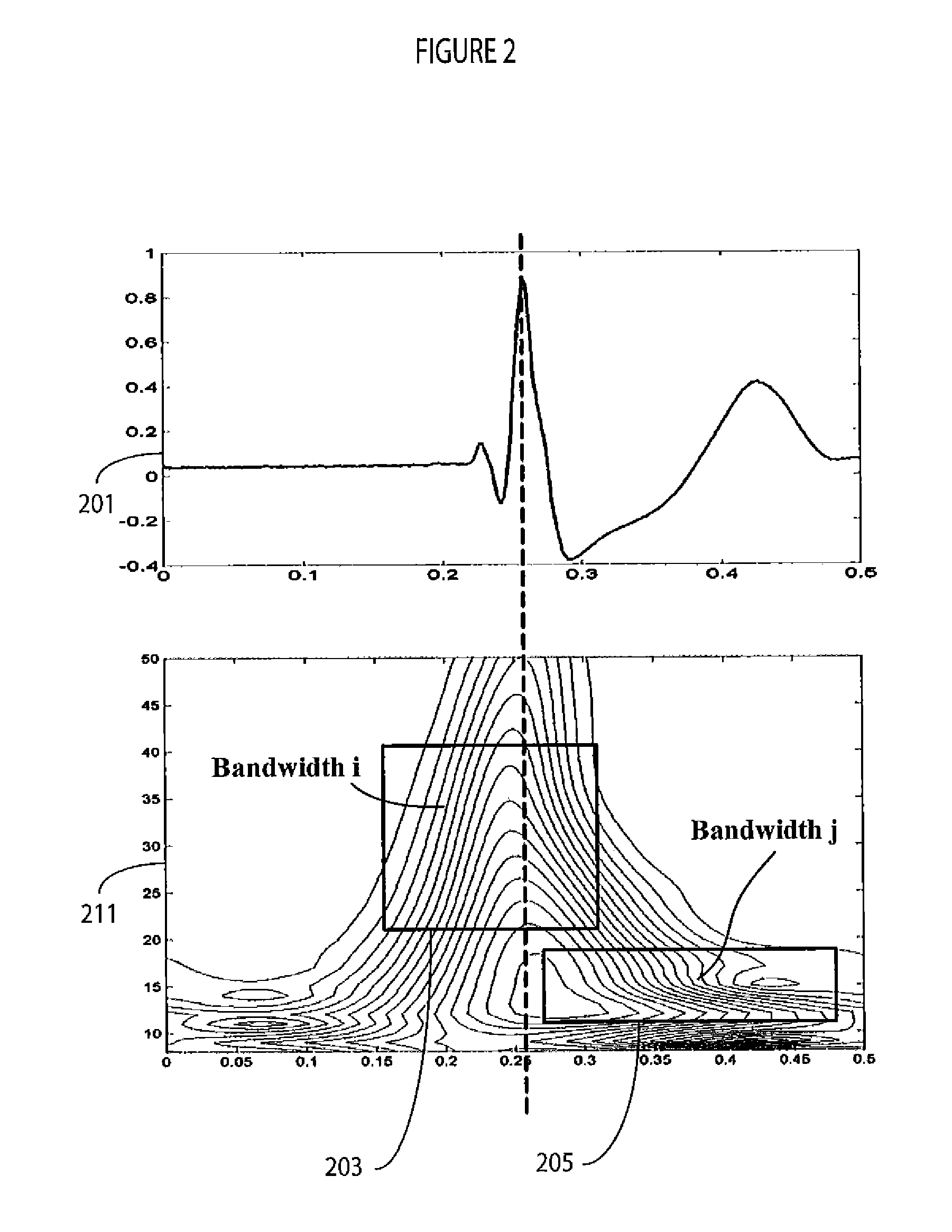 System for Ventricular Function Abnormality Detection and Characterization