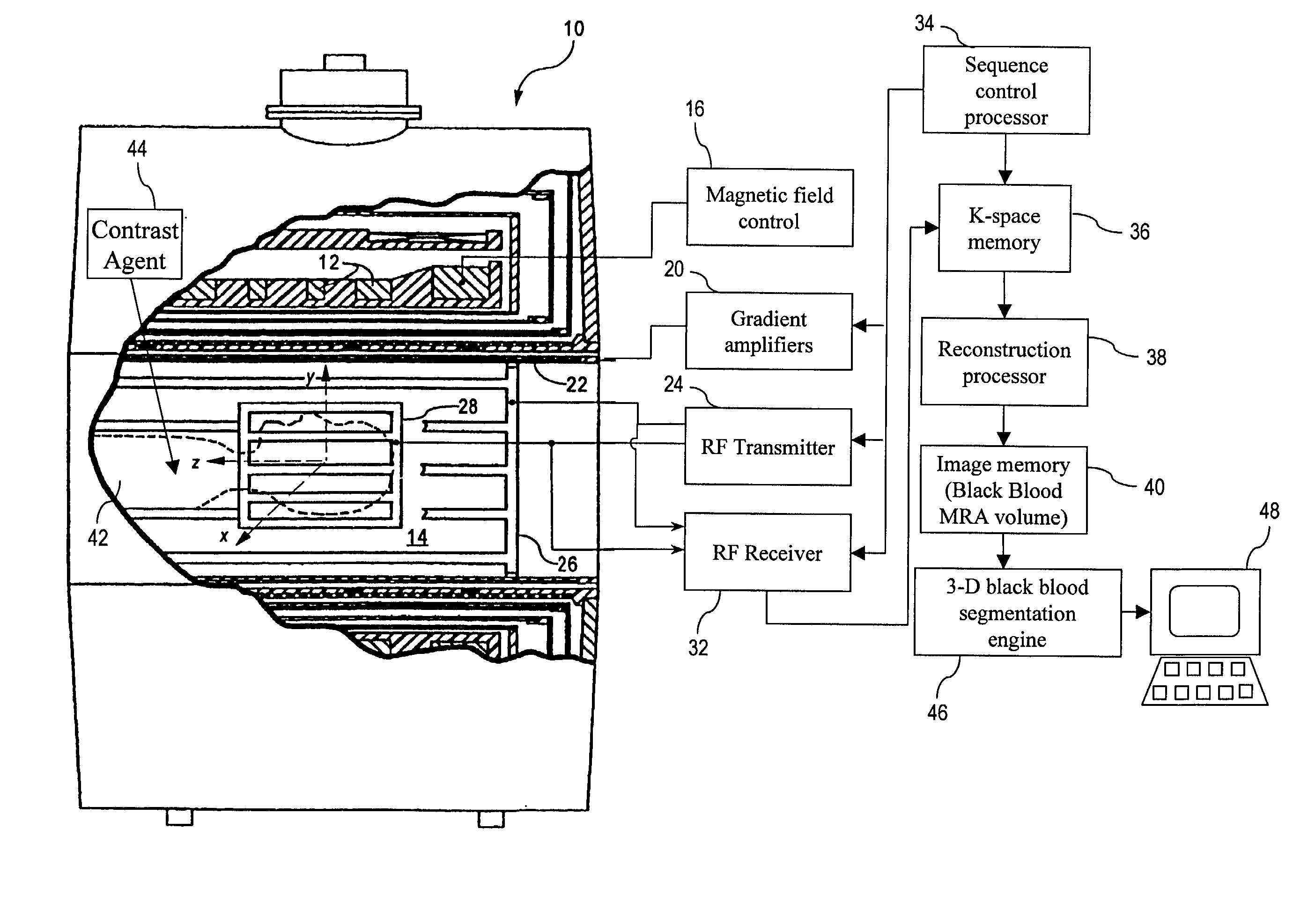 Black blood angiography method and apparatus