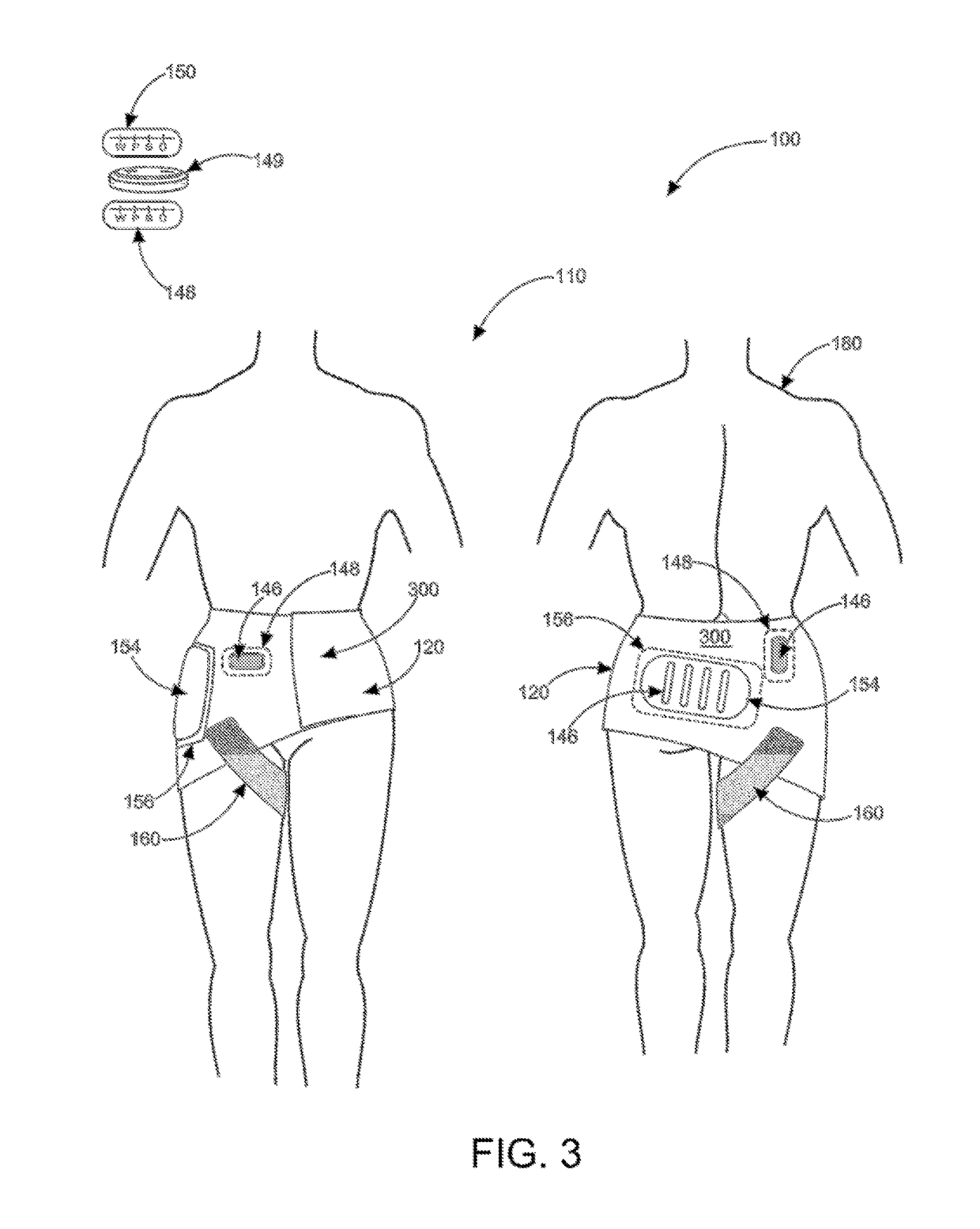 V-band therapeutic wrapping systems