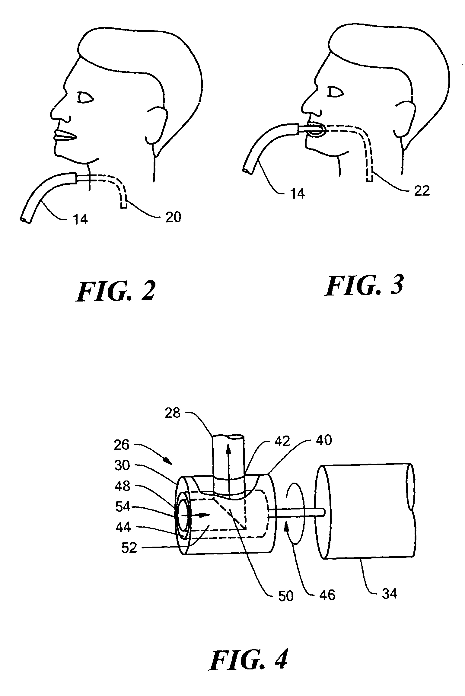 Insufflation-exsufflation system with percussive assist for removal of broncho-pulmonary secretions