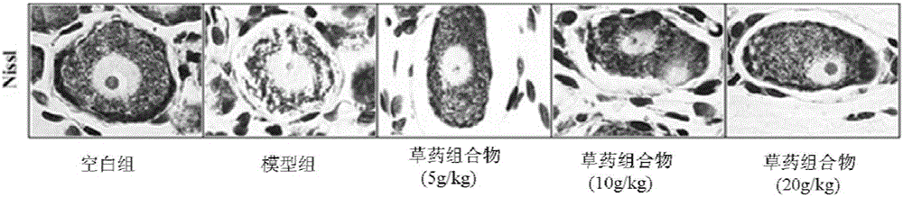 A kind of pharmaceutical composition for treating cancer and its application