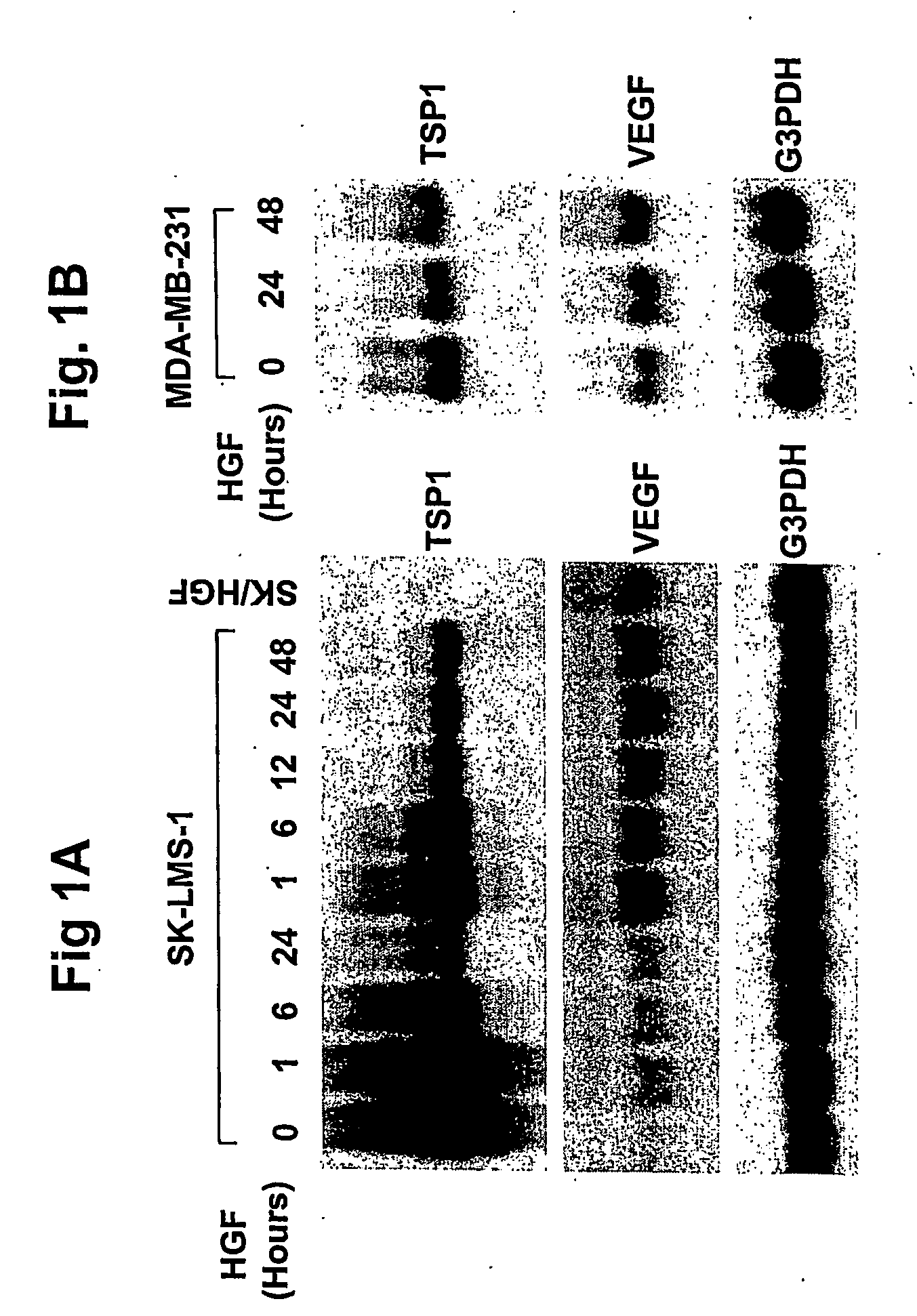 Inhibition of tumor angiogenesis by combination of thrombospondin-1 and inhibitors of vascular endothelial growth factor