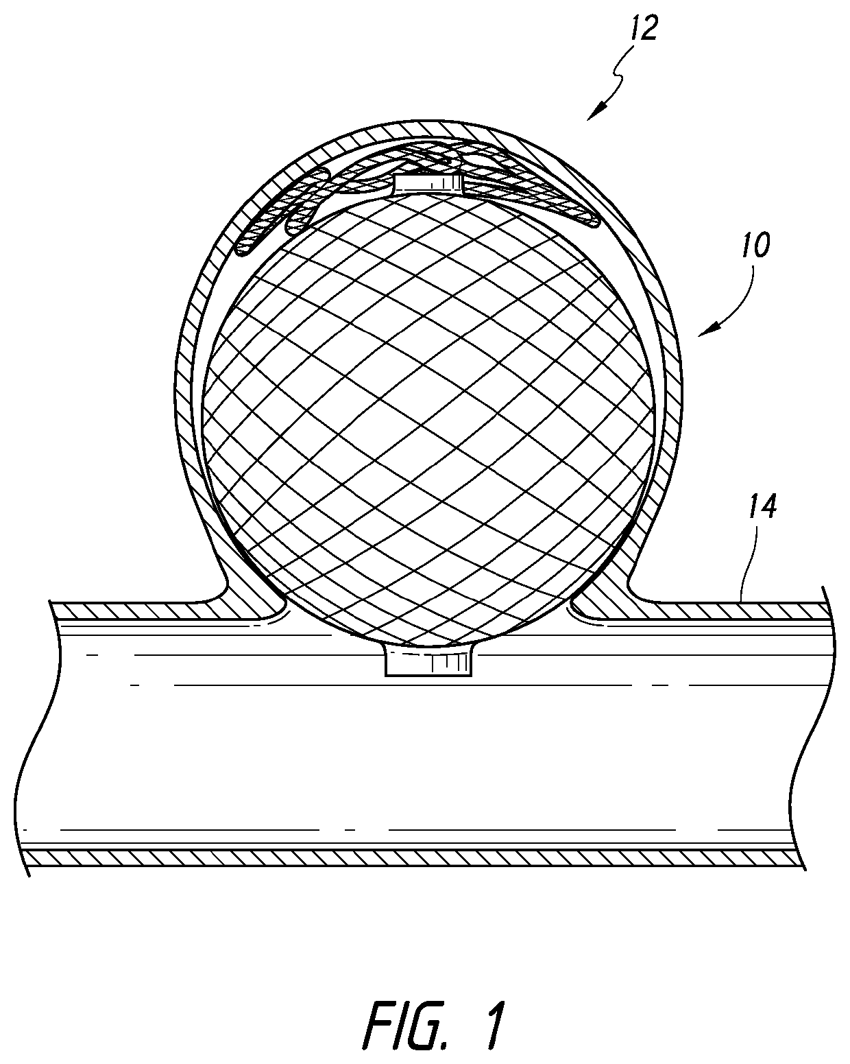 Occlusive device