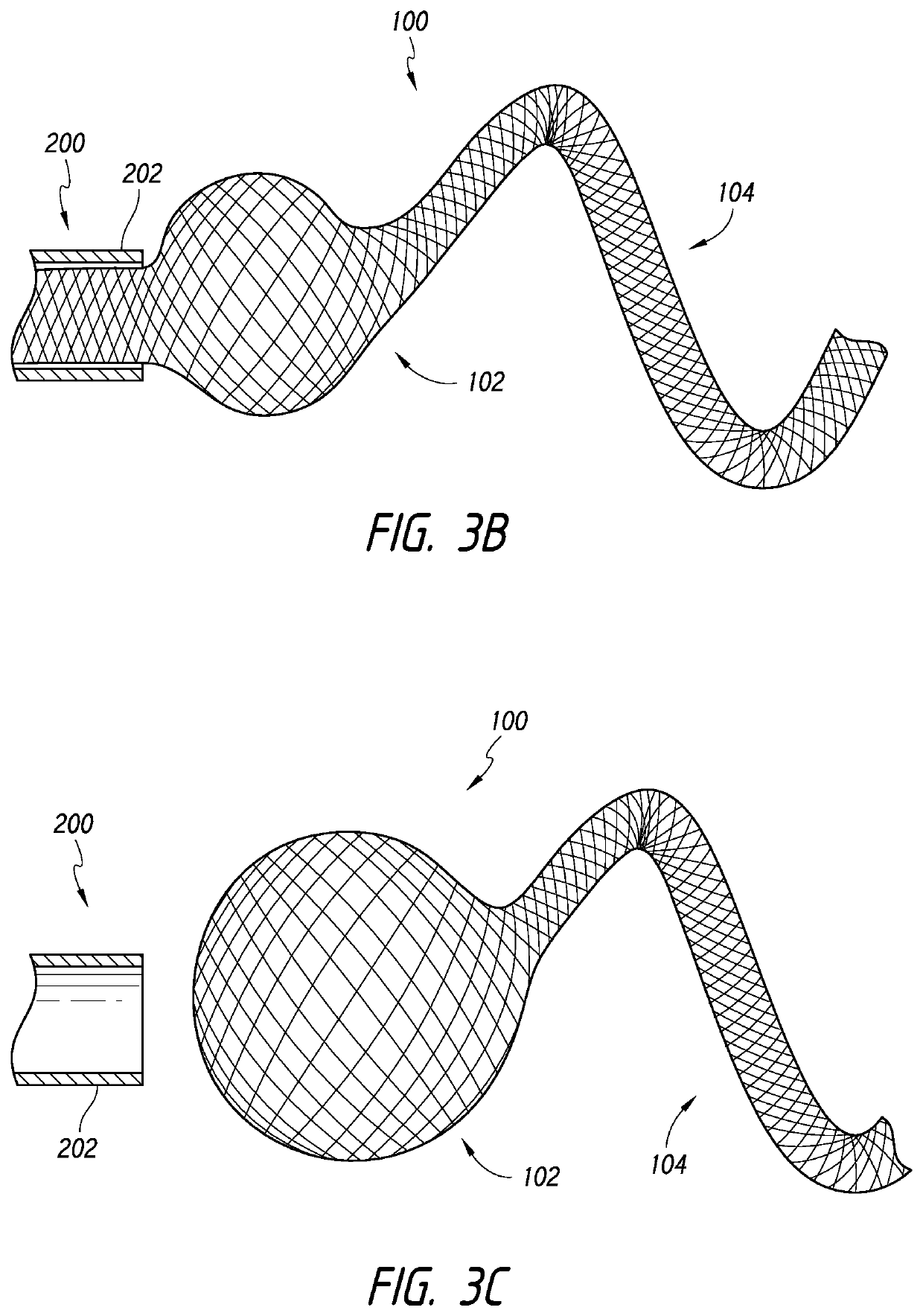 Occlusive device