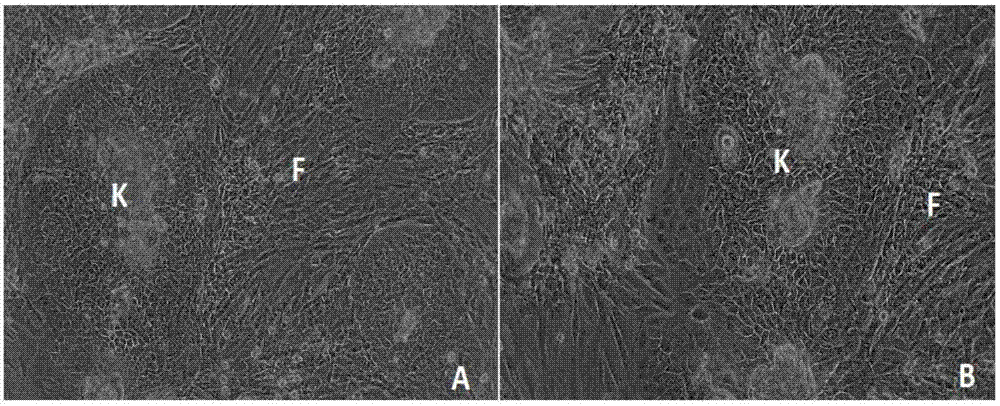 A wound-adhesive artificial active tissue constructed with serum-free and bovine pituitary extract culture fluid and its construction method