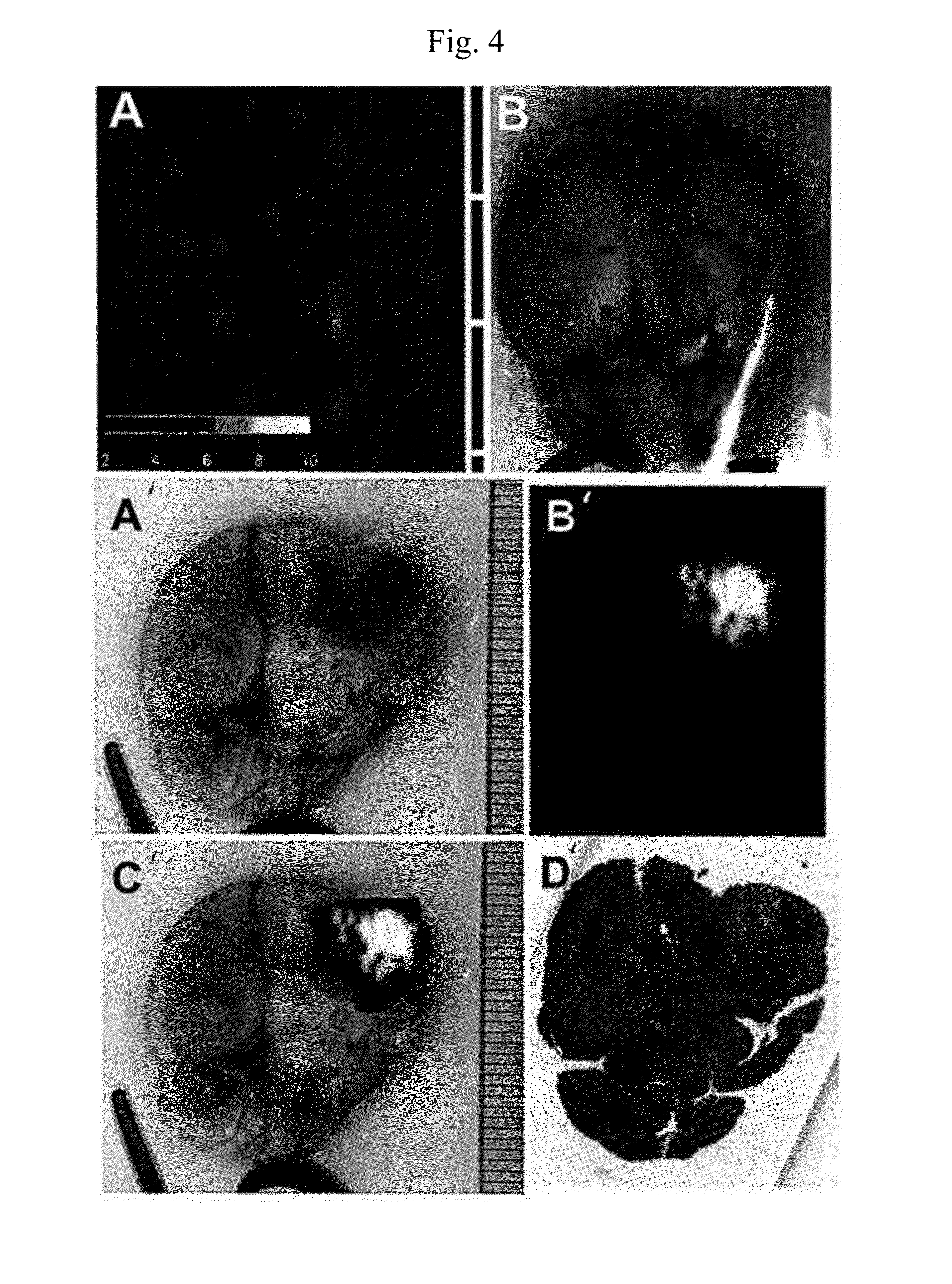 Phospholipid Ether Analogs as Cancer-Targeting Drug Vehicles