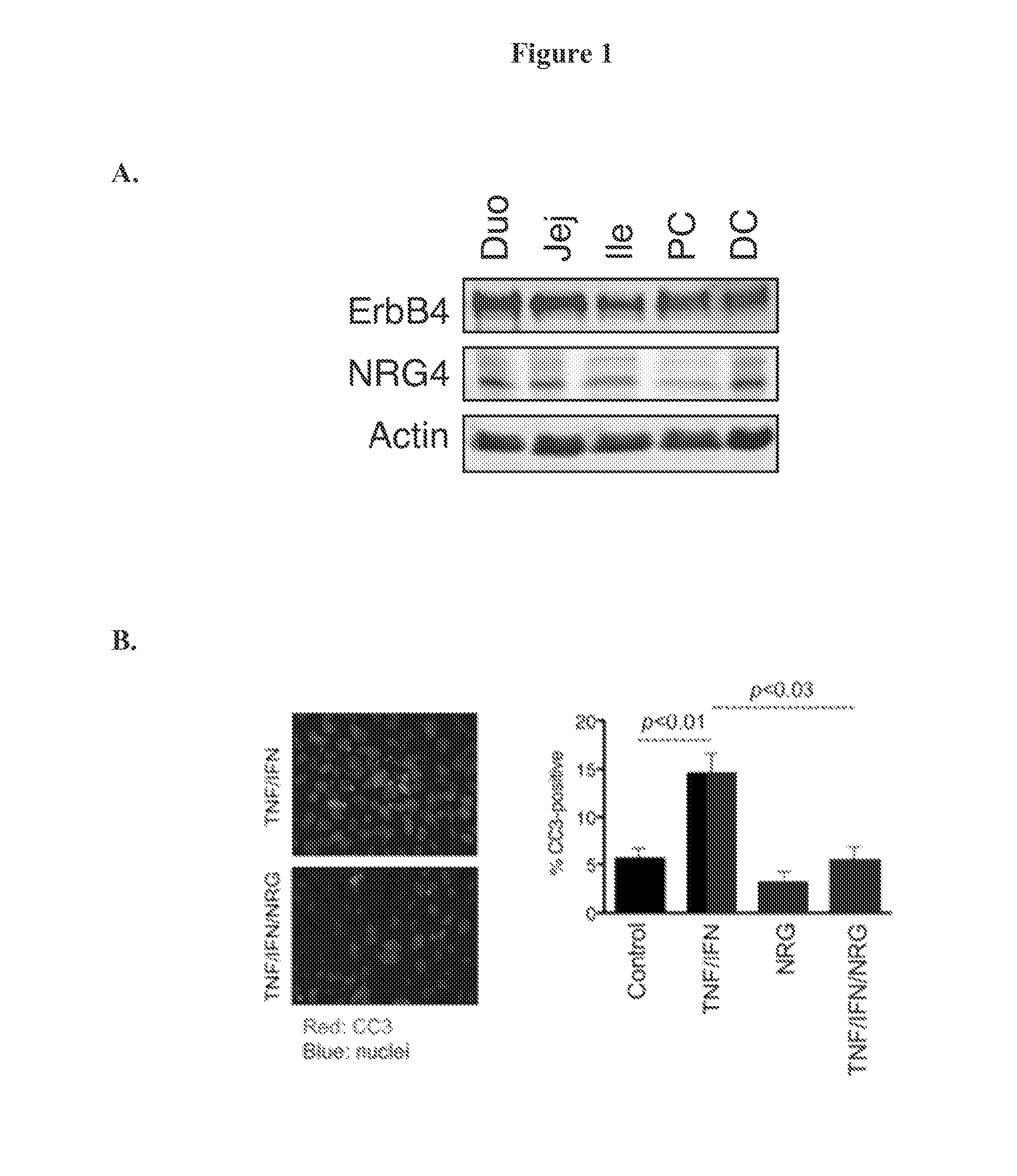 Use of neuregulin-4 for treatment of inflammatory bowel disease and necrotizing enterocolitis