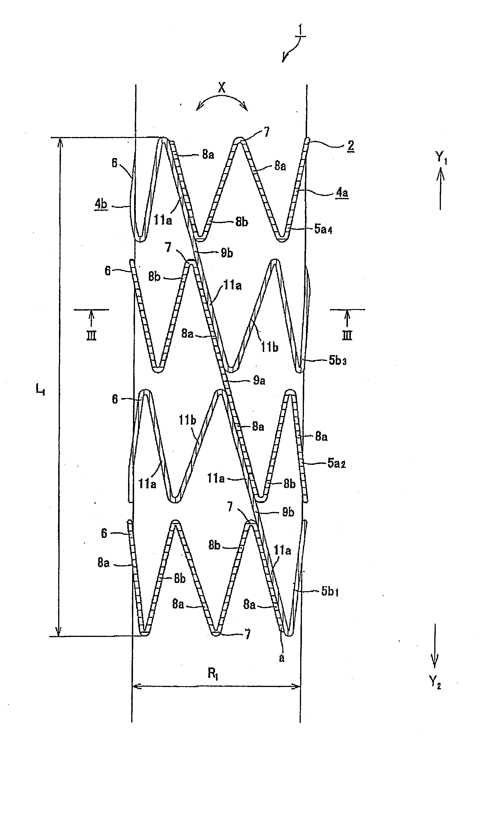 Stent for Vessel