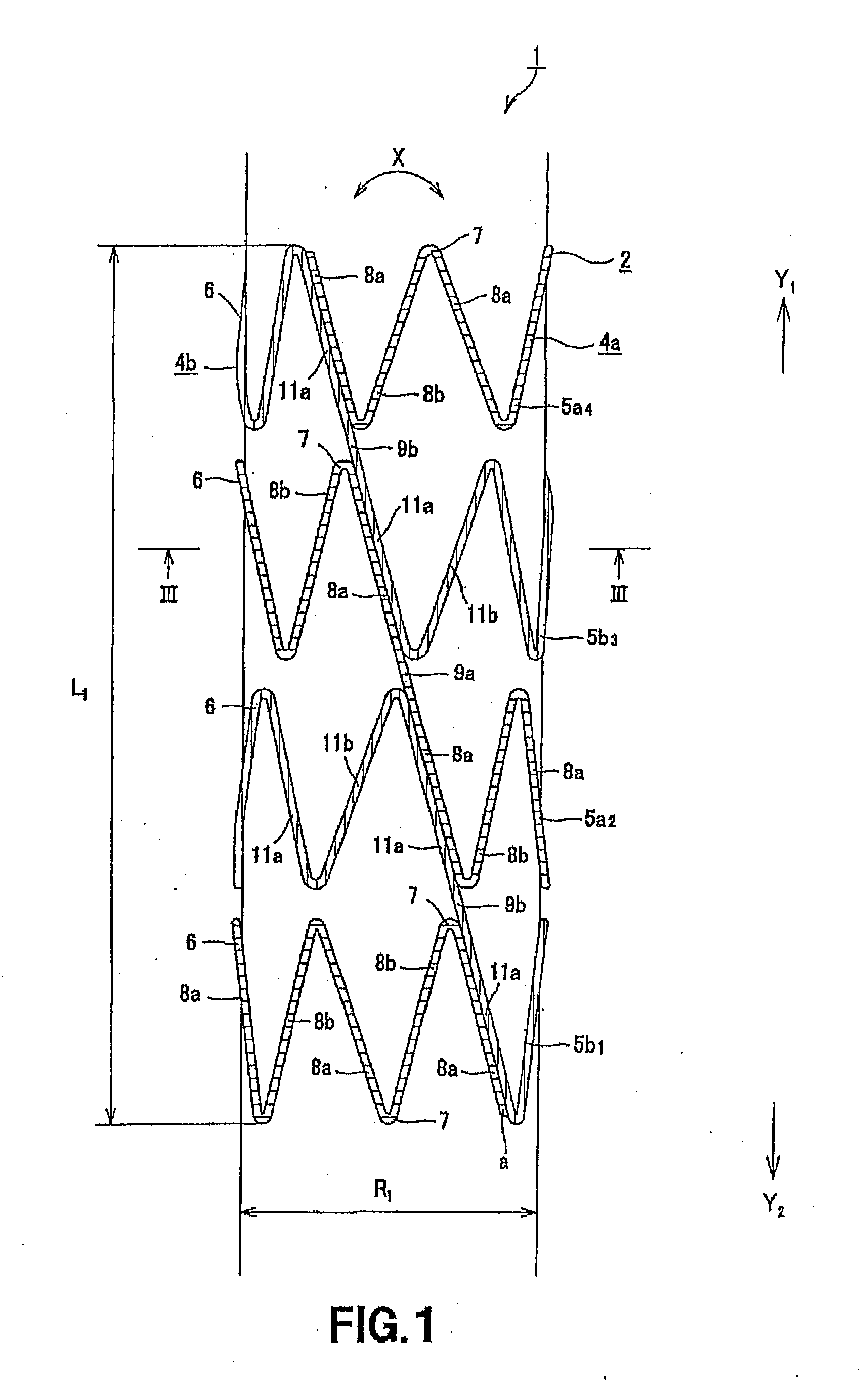 Stent for Vessel