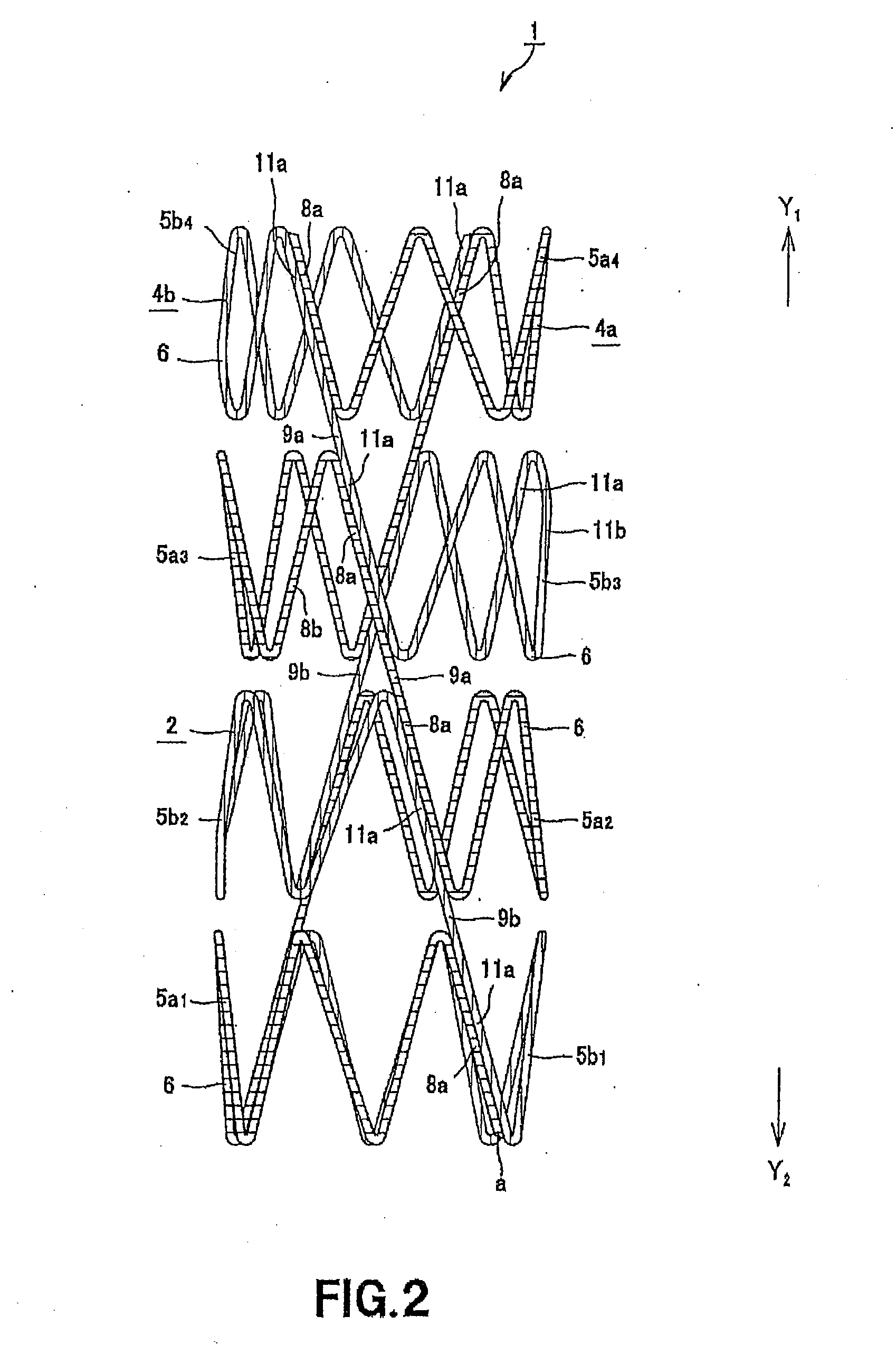 Stent for Vessel