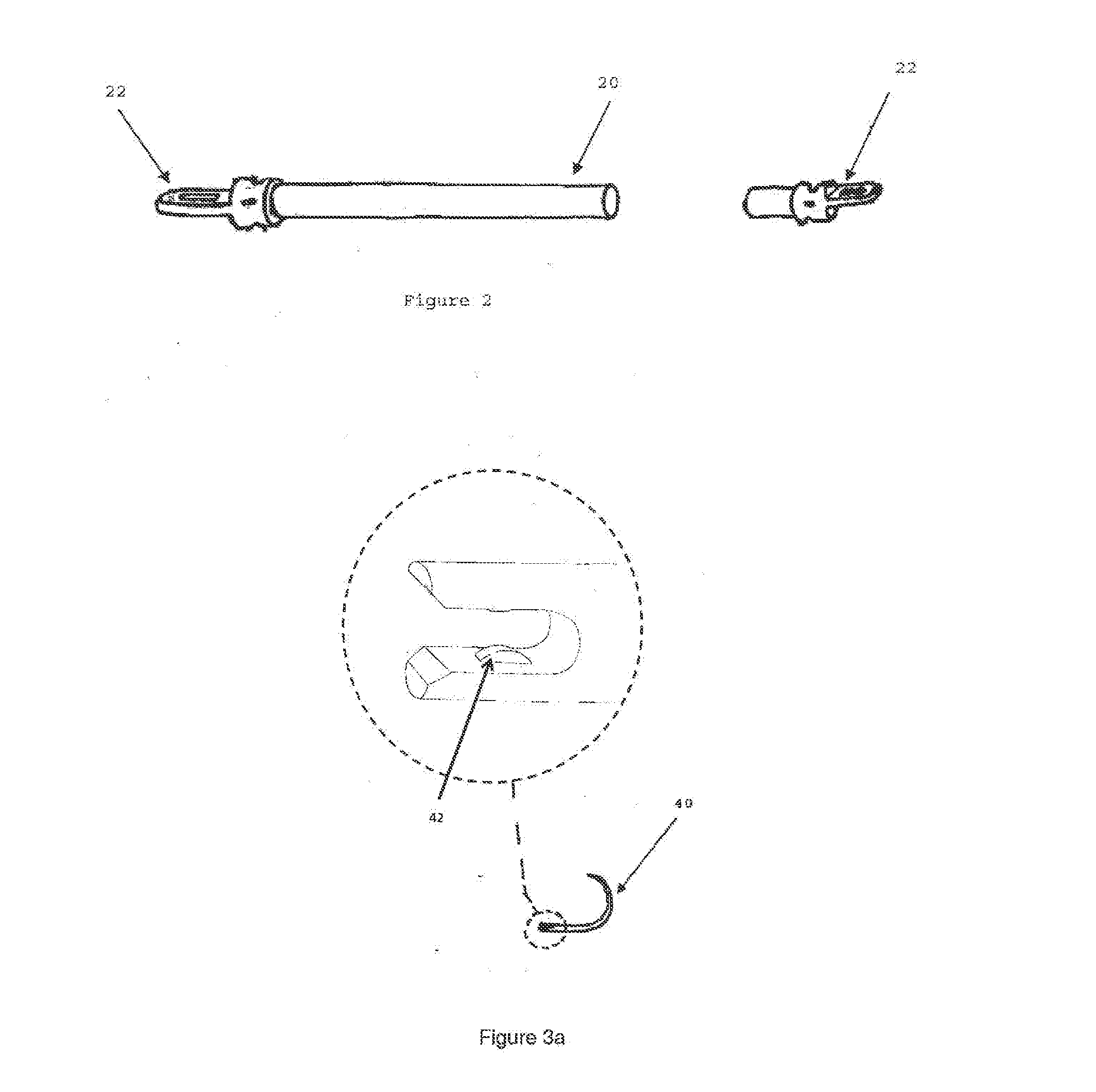 Modular Tissue Securement Systems