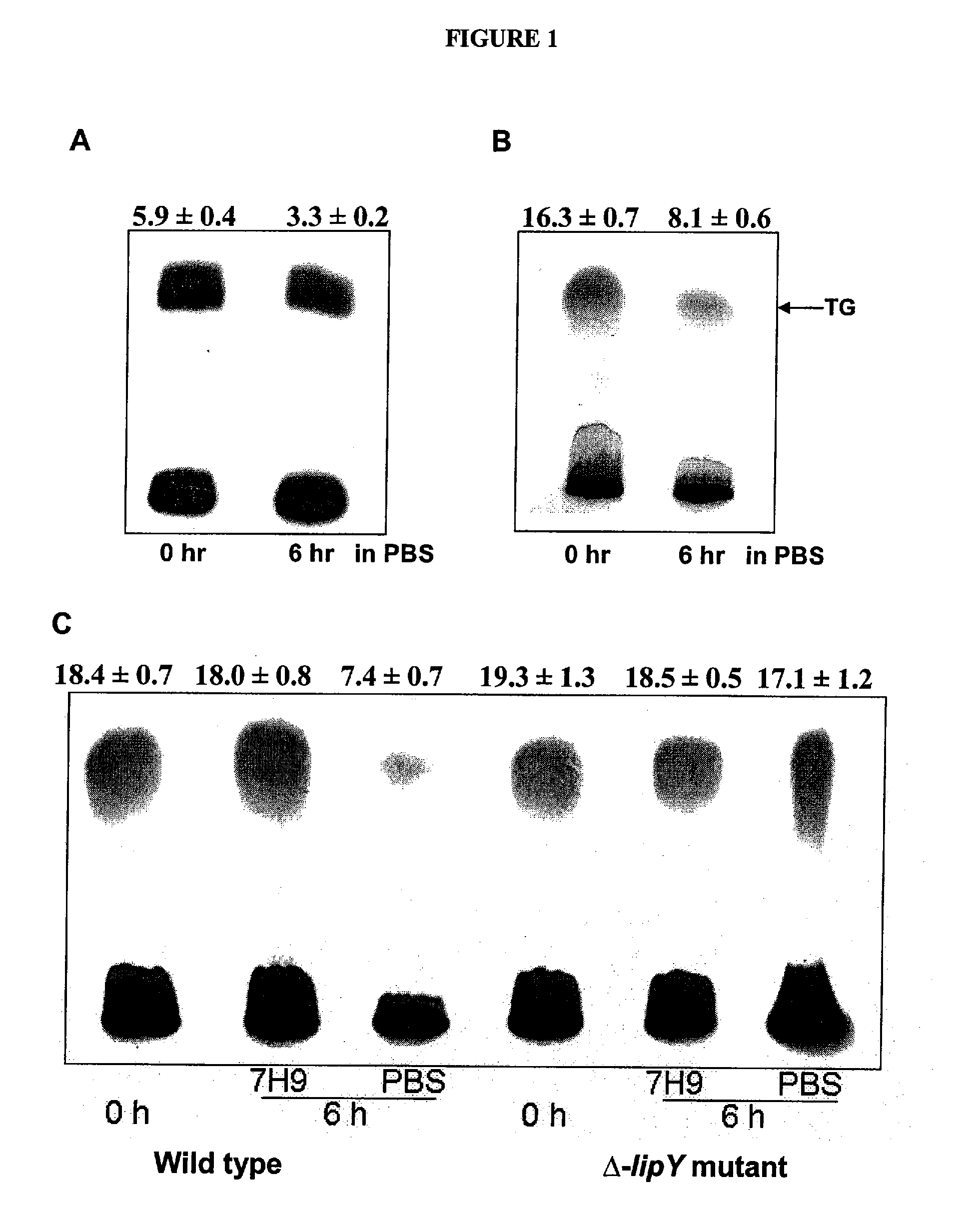 Targeting of long chain triacylglycerol hydrolase gene for tuberculosis treatment