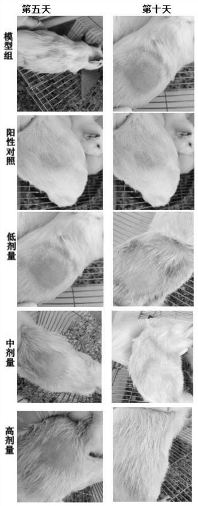 Traditional Chinese medicine leavening and application thereof in preparation of medicine for treating dermatosis caused by fungal infection