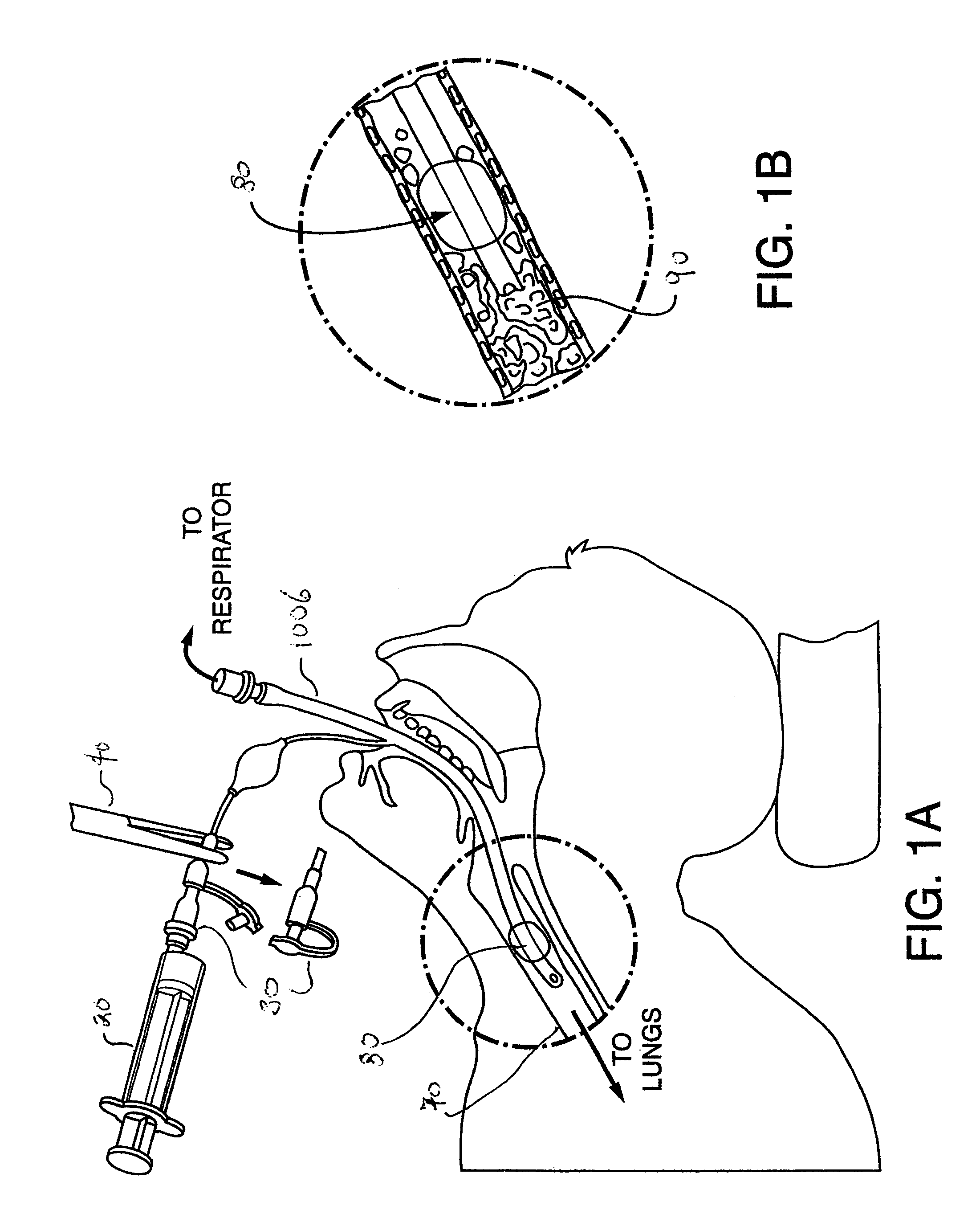 Methods, devices and formulations for targeted endobronchial therapy